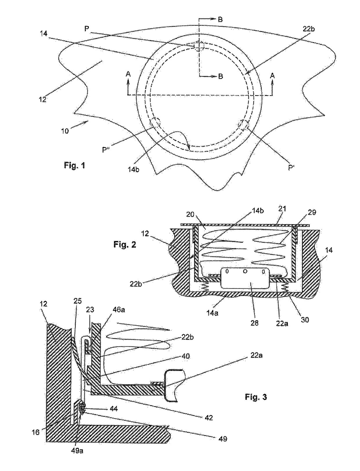 Steering wheel unit, airbag module, and steering wheel body