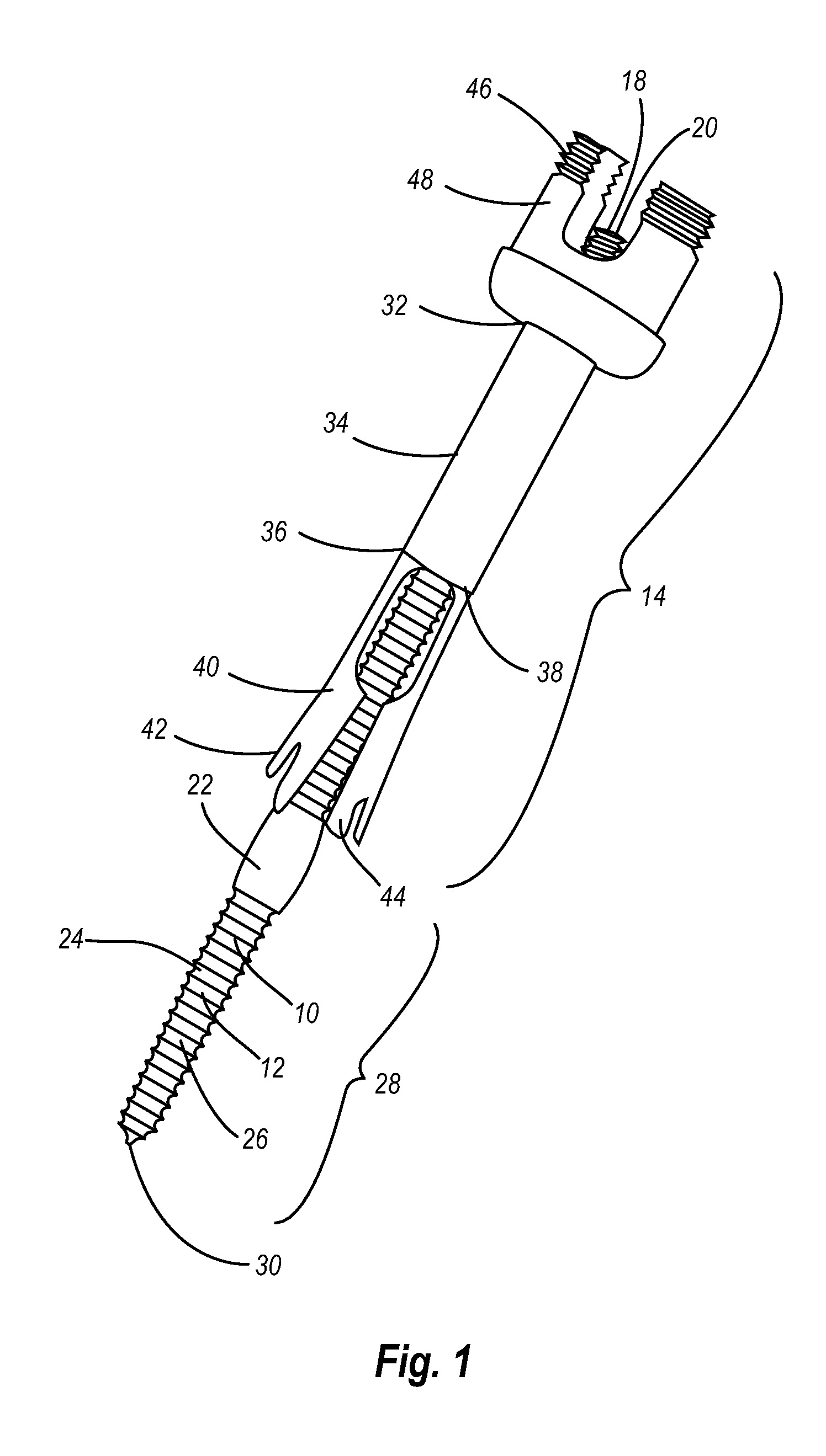 Osteoporatic screw and expansion sleeve