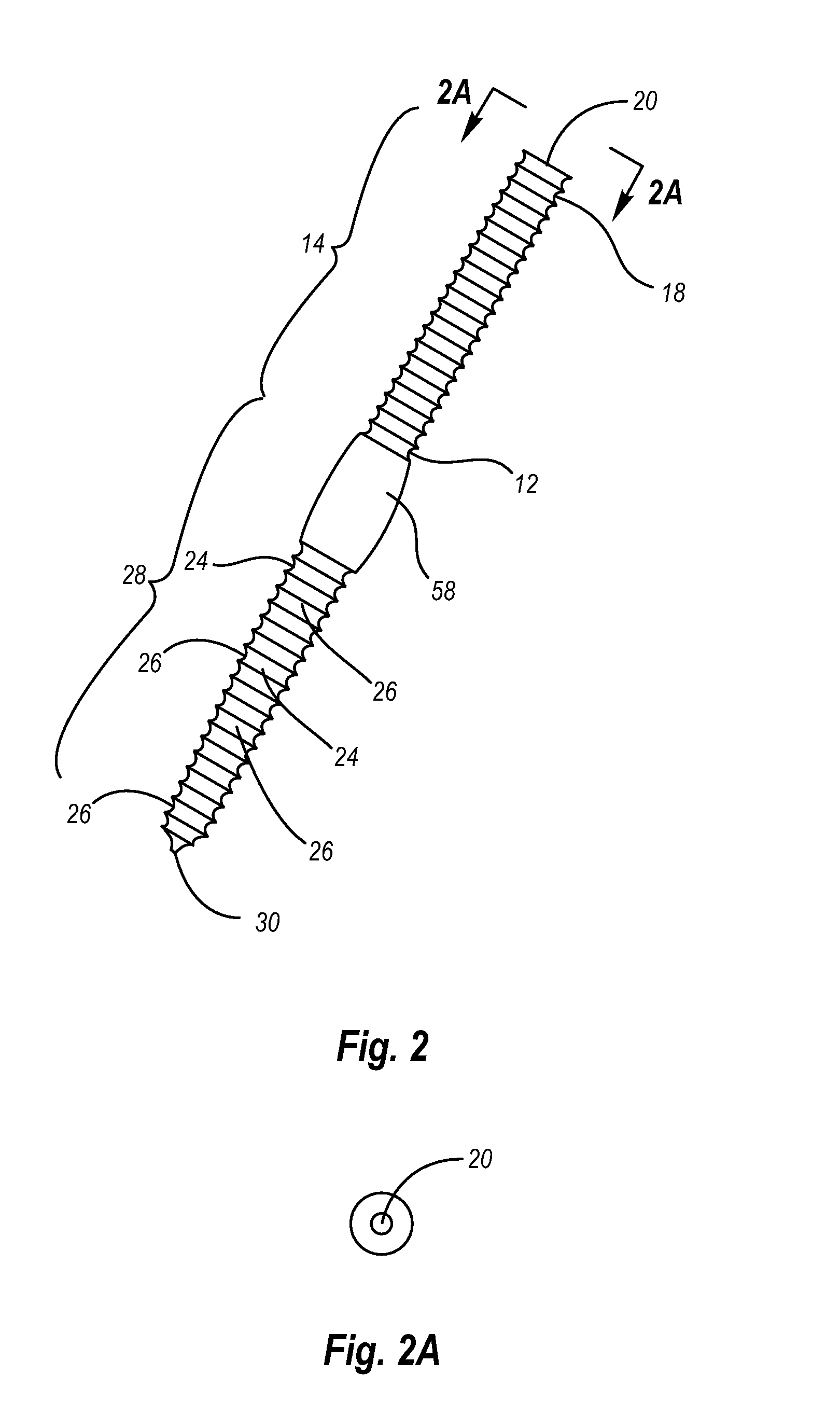 Osteoporatic screw and expansion sleeve