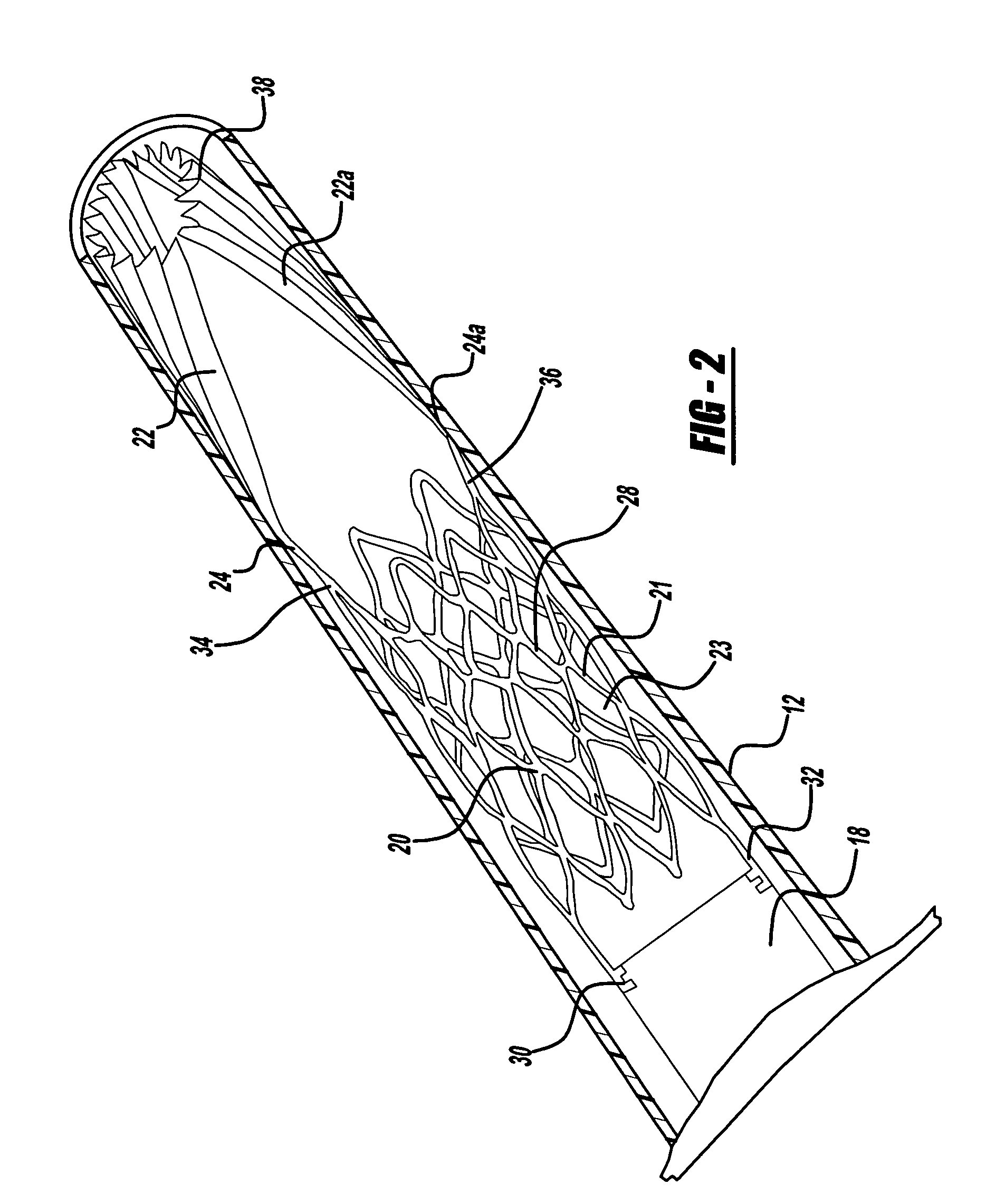 Neck covering device for an aneurysm