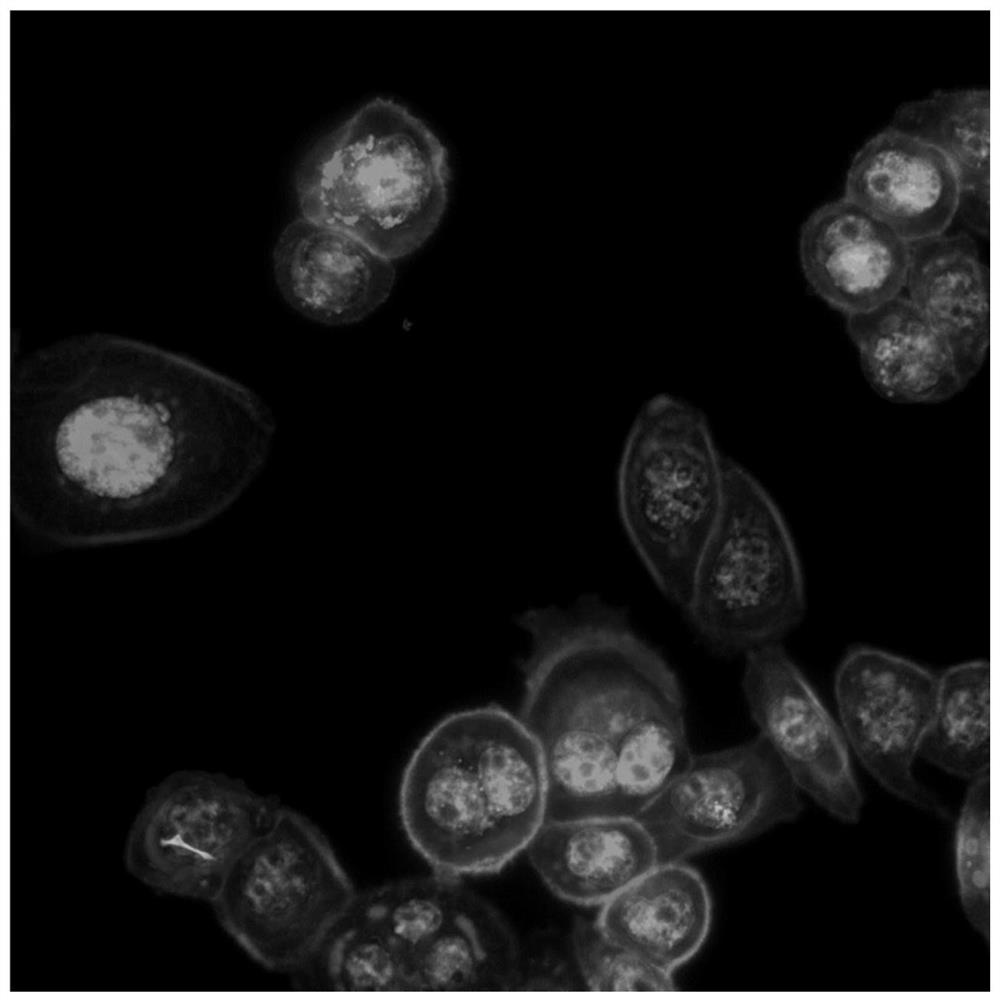 Cell drug resistance detection method based on high content imaging, medium and electronic equipment