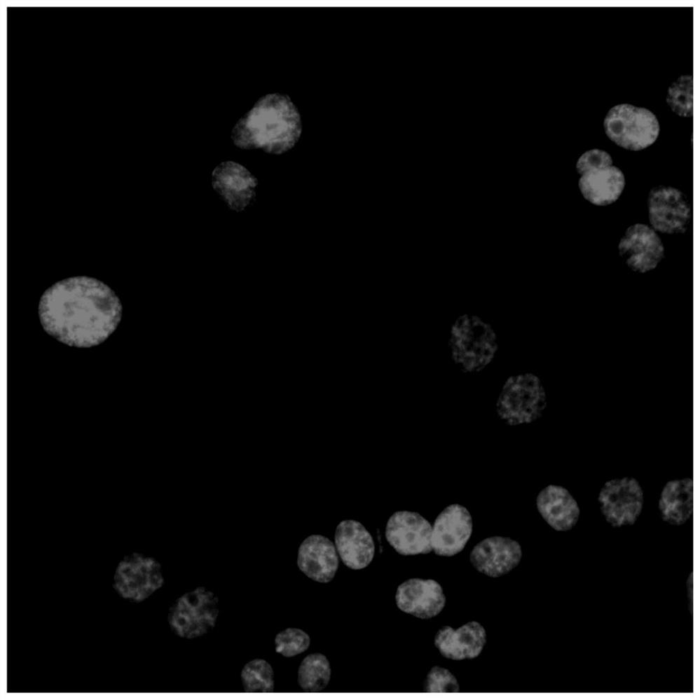 Cell drug resistance detection method based on high content imaging, medium and electronic equipment