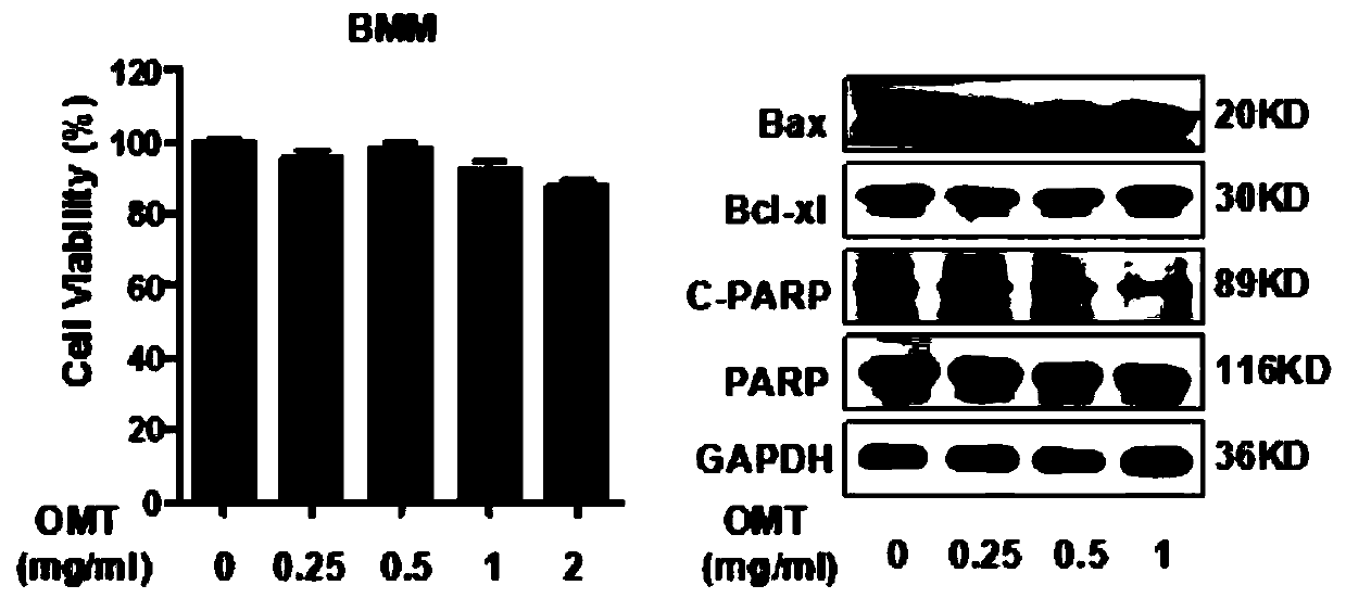 Application of oxymatrine in the preparation of anti-osteoclast-mediated bone loss drugs