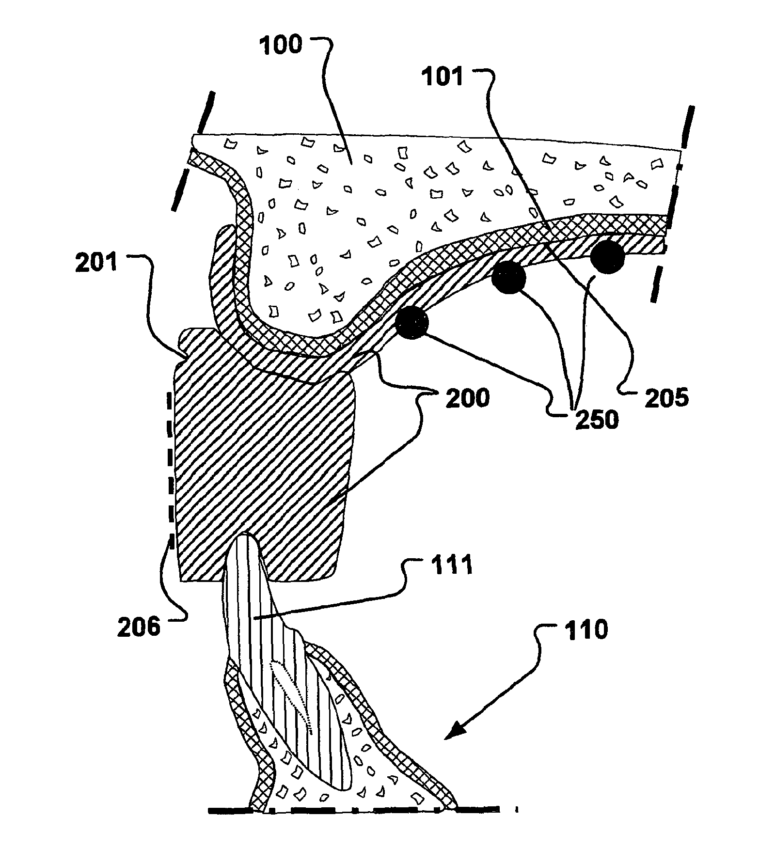 System and method for planning a first and second dental restoration