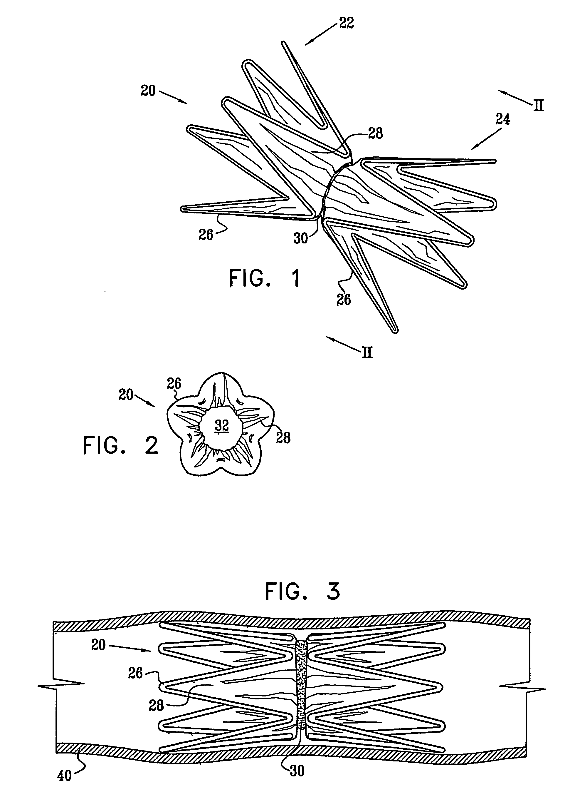 Vascular implant