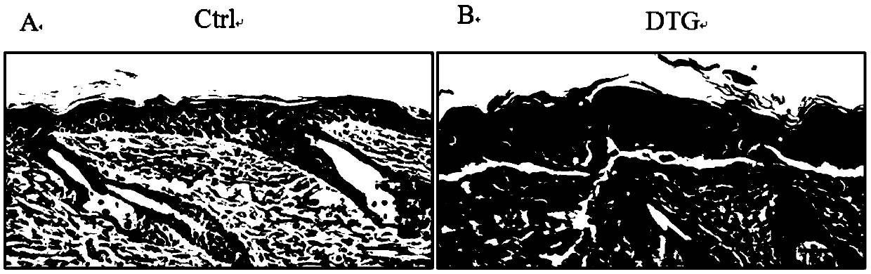 Application of rapamycin and structural analogues thereof in preparation of drug for treating diseases caused by Msi1 gene ectopic overexpression