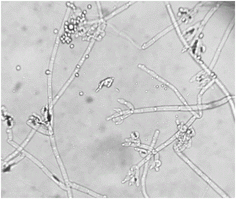 Trichoderma harzianum strain Th-N5 resisting carbendazim and application of trichoderma harzianum strain Th-N5