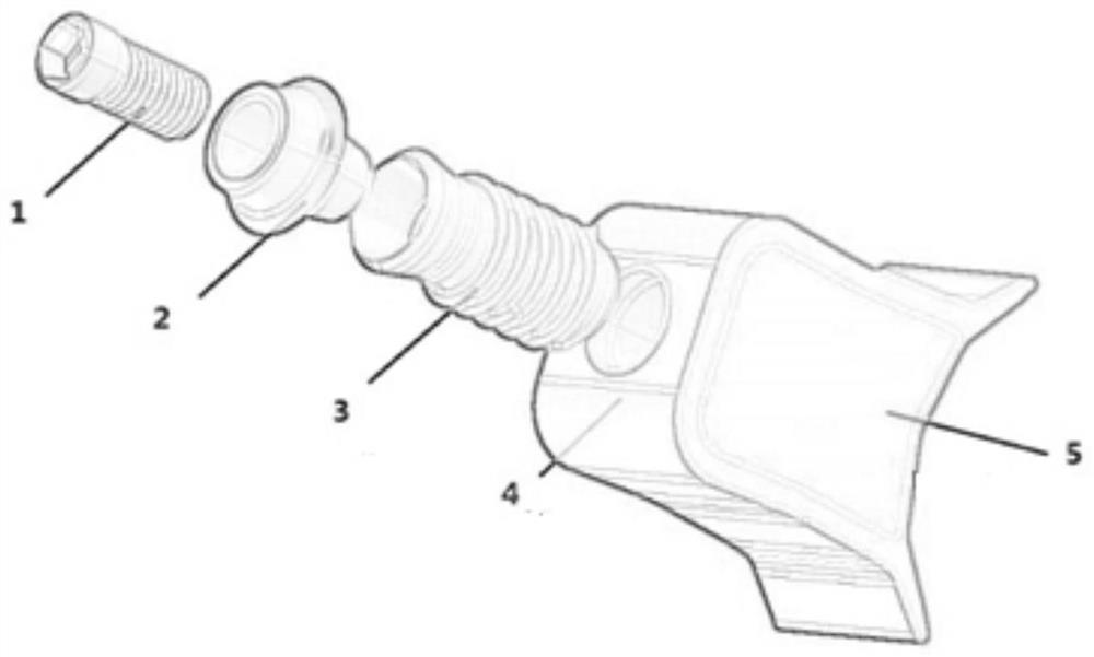 Implant structure optimization method based on finite element model