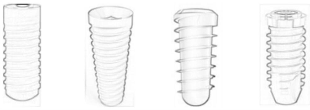 Implant structure optimization method based on finite element model