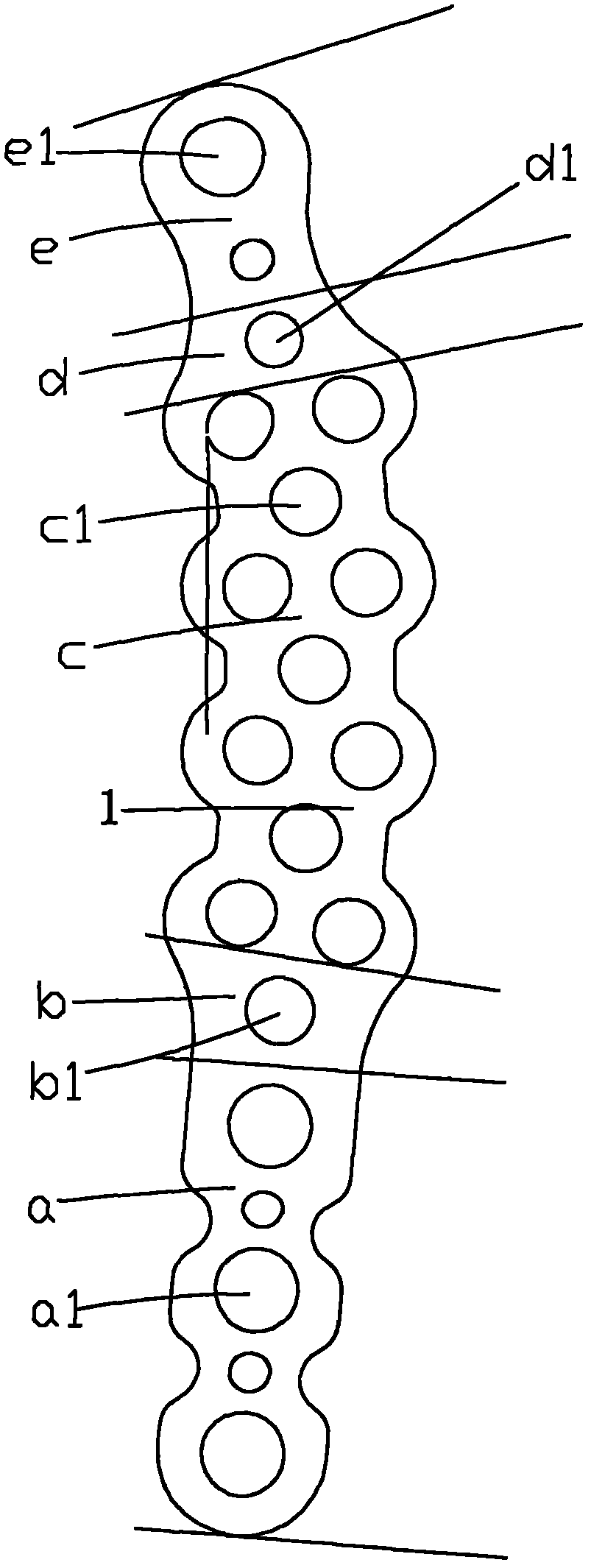 Self-locking acetabular posterior-wall posterior-column anatomical steel plate