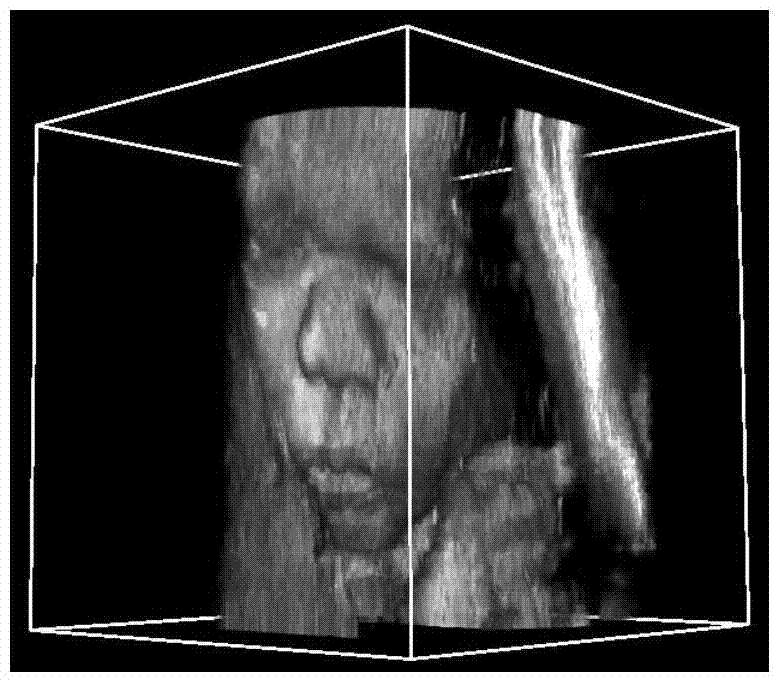 Non-local mean filter method for three-dimensional ultrasonic images