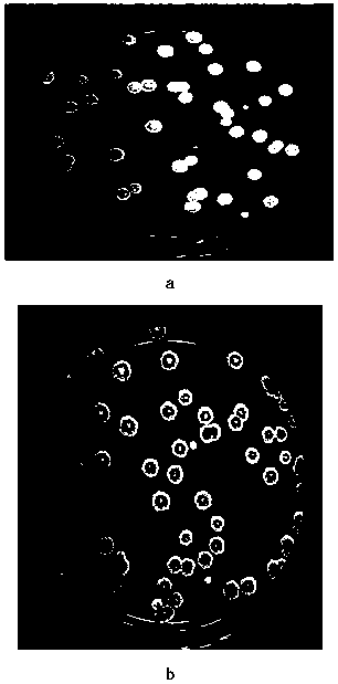 High-yield glutamine transaminase strain and application thereof