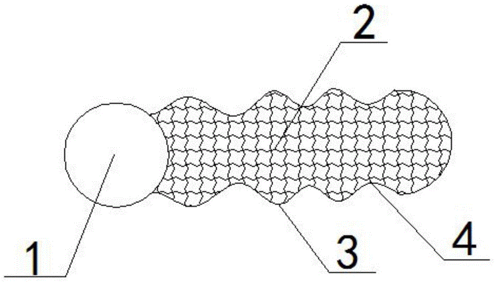 Degradable prostate stent