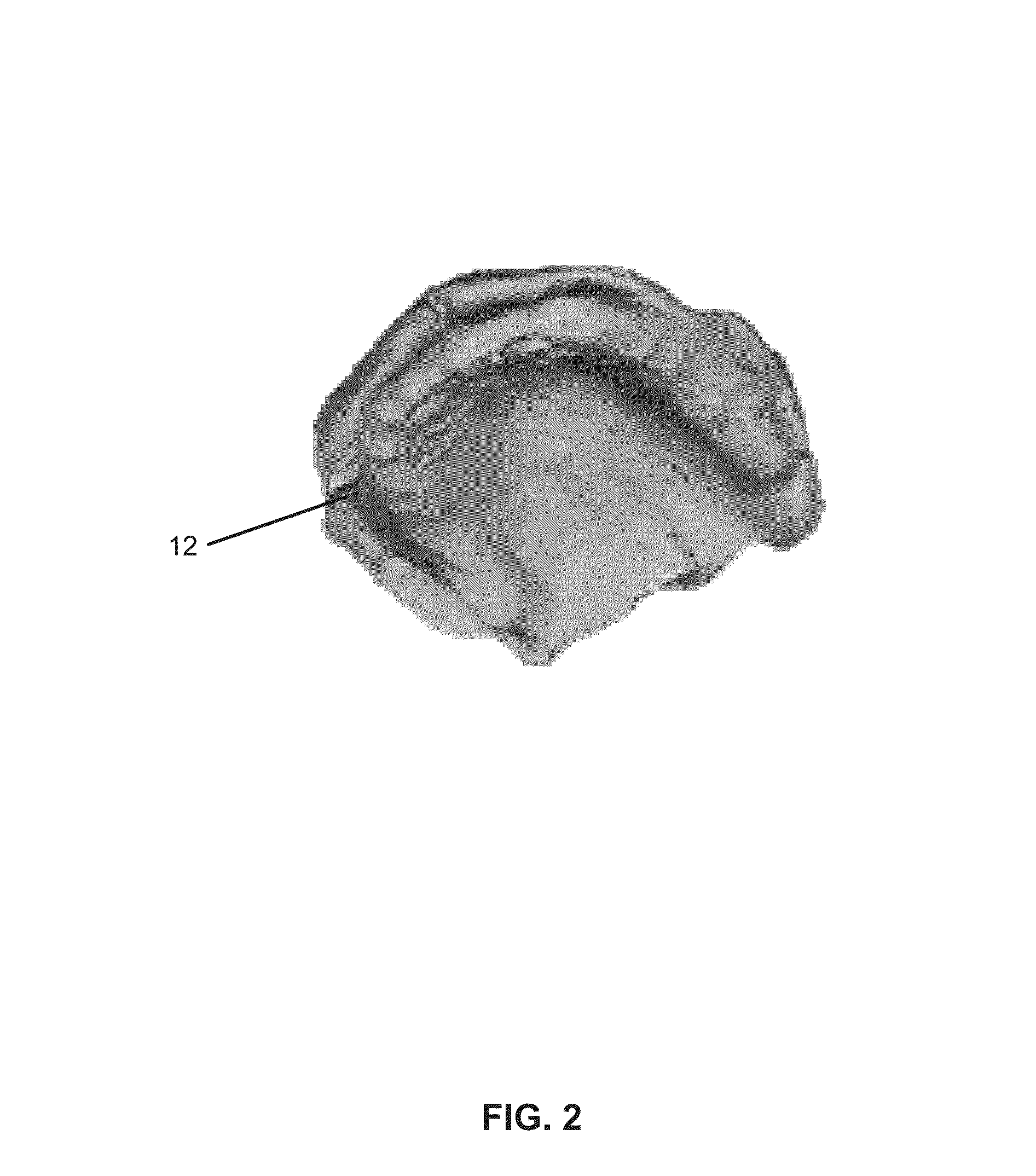 System and process for optimization of dentures