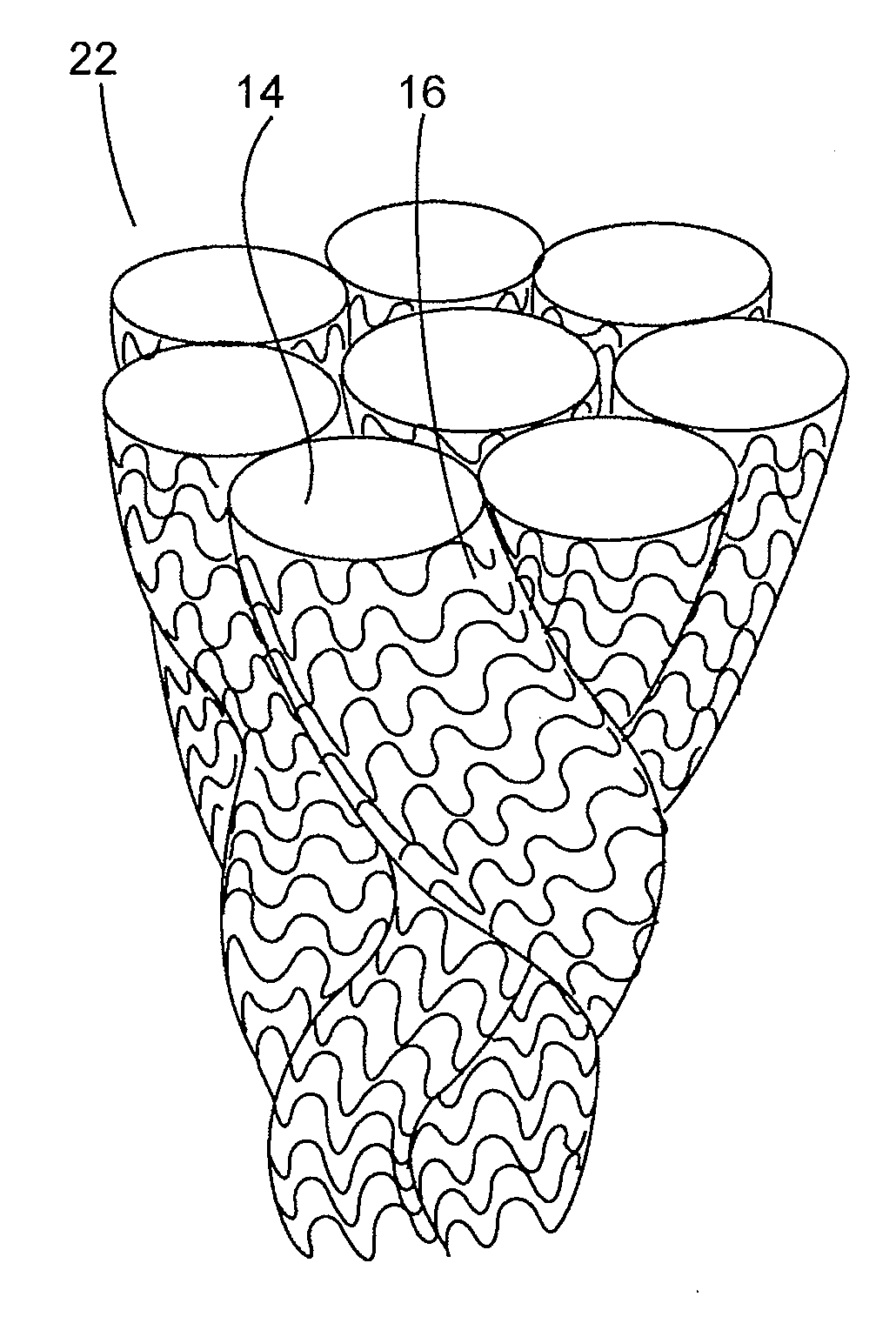 Three Dimensional Implant