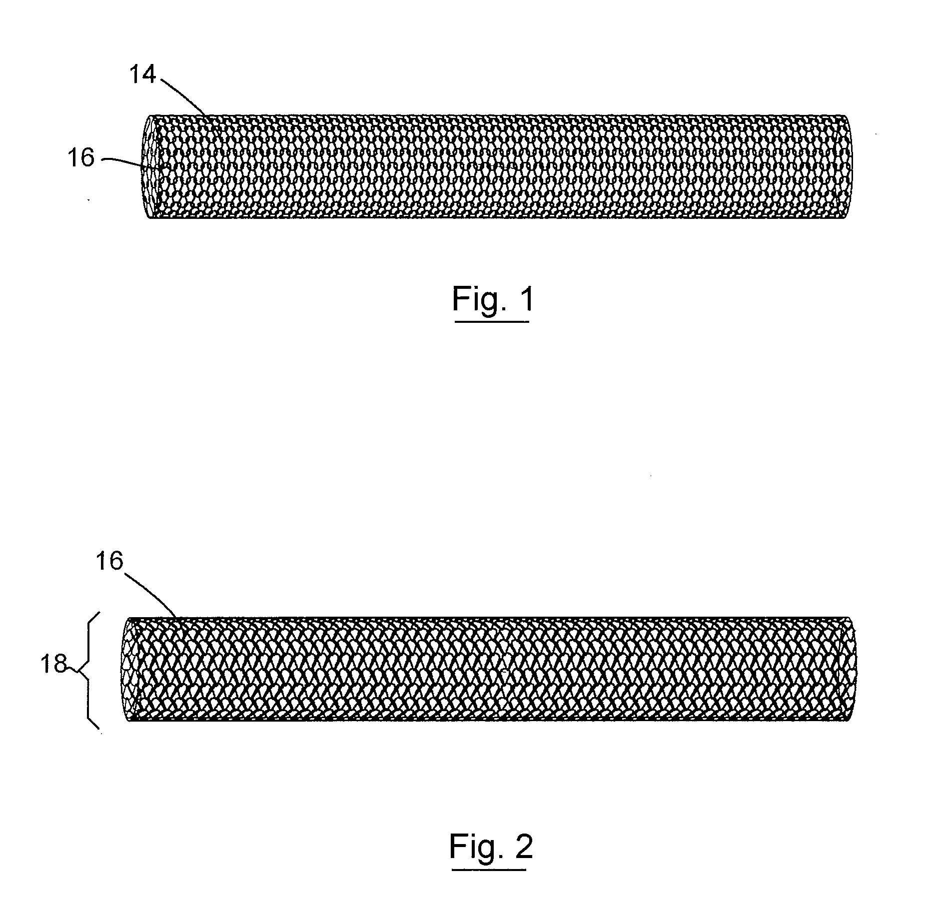 Three Dimensional Implant