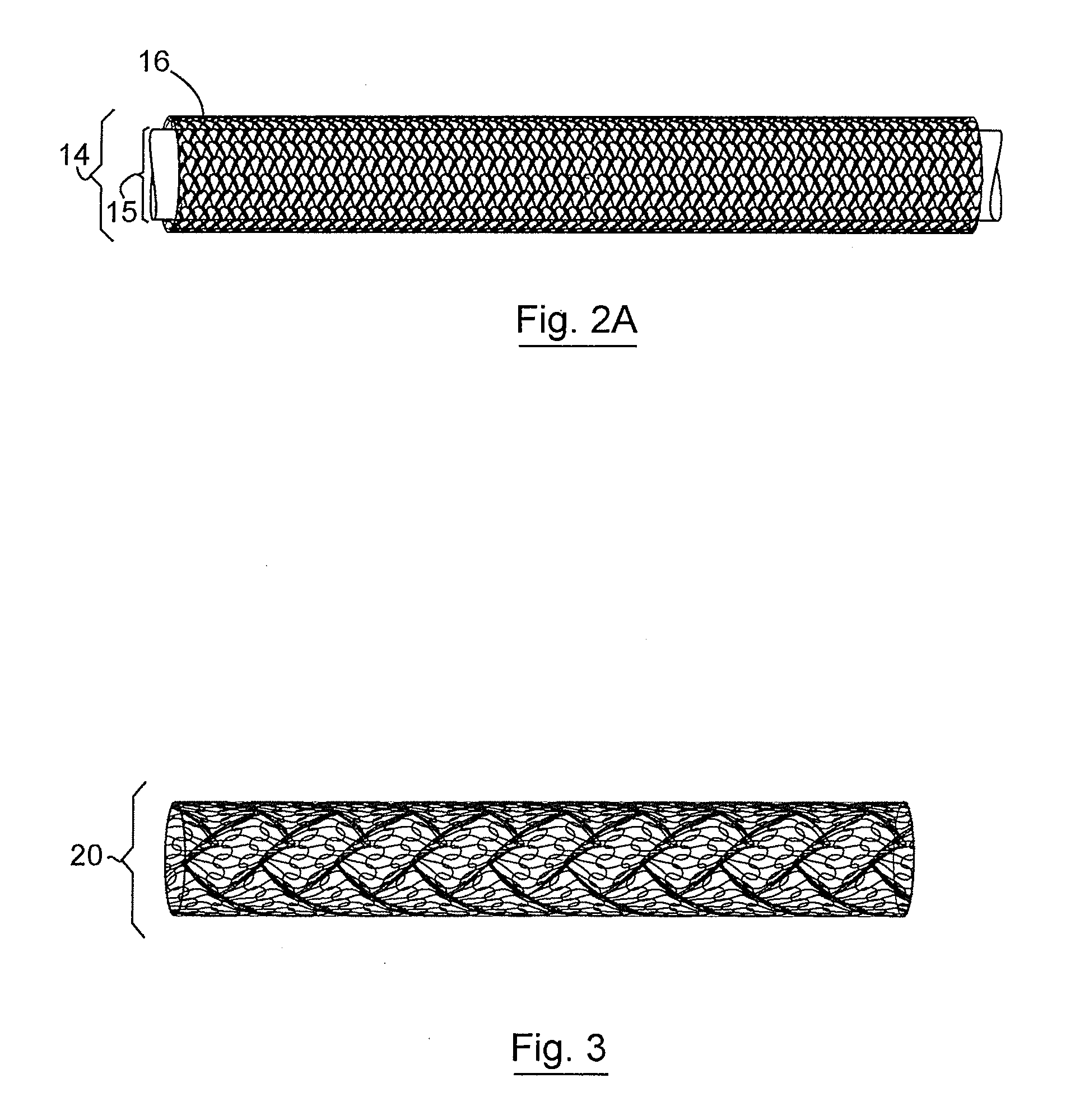 Three Dimensional Implant