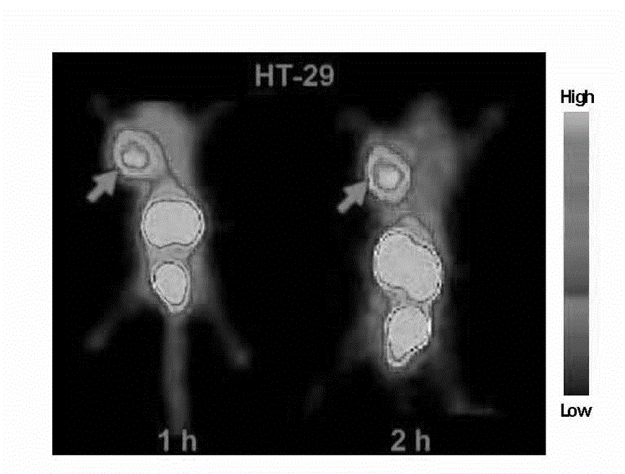 Novel VQ polypeptide radioactive medicine and preparation method thereof