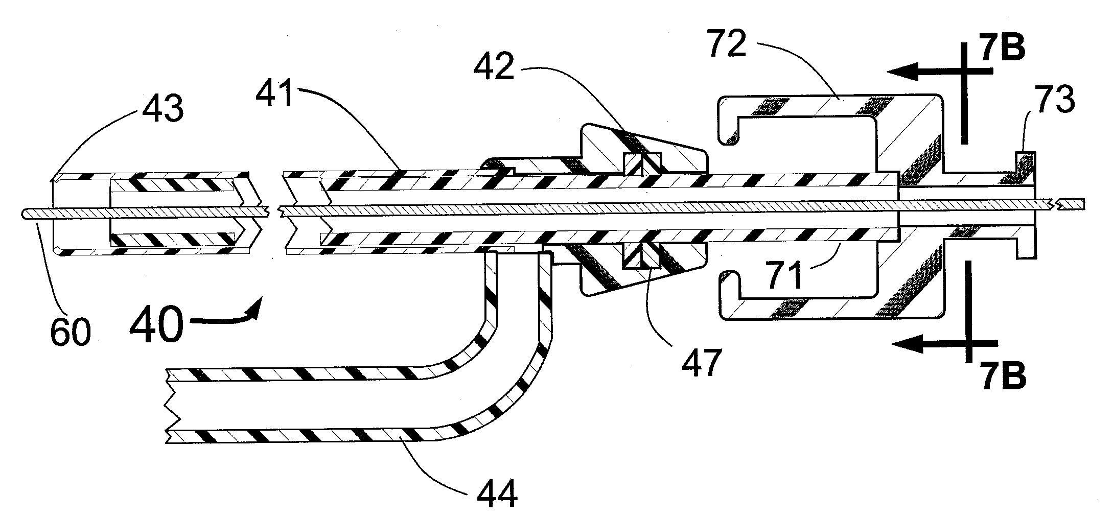 System and method for performing angiography and stenting