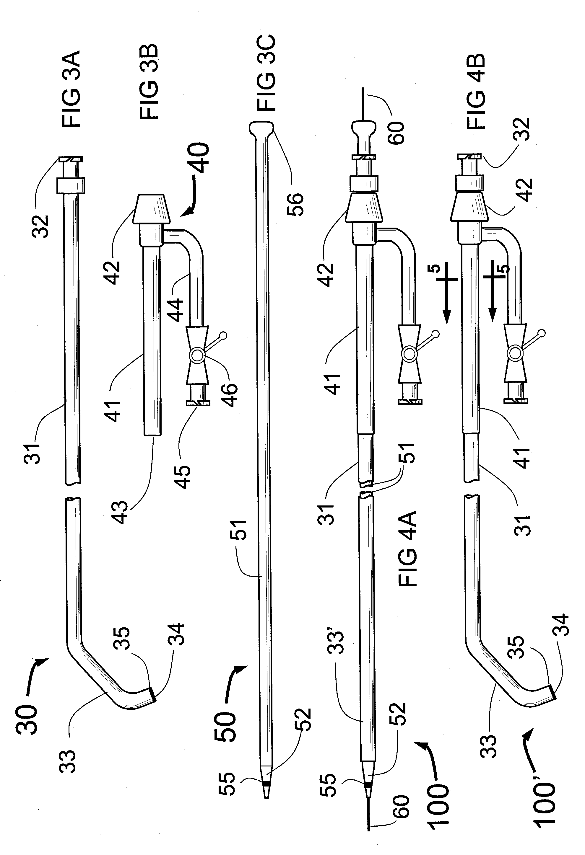 System and method for performing angiography and stenting