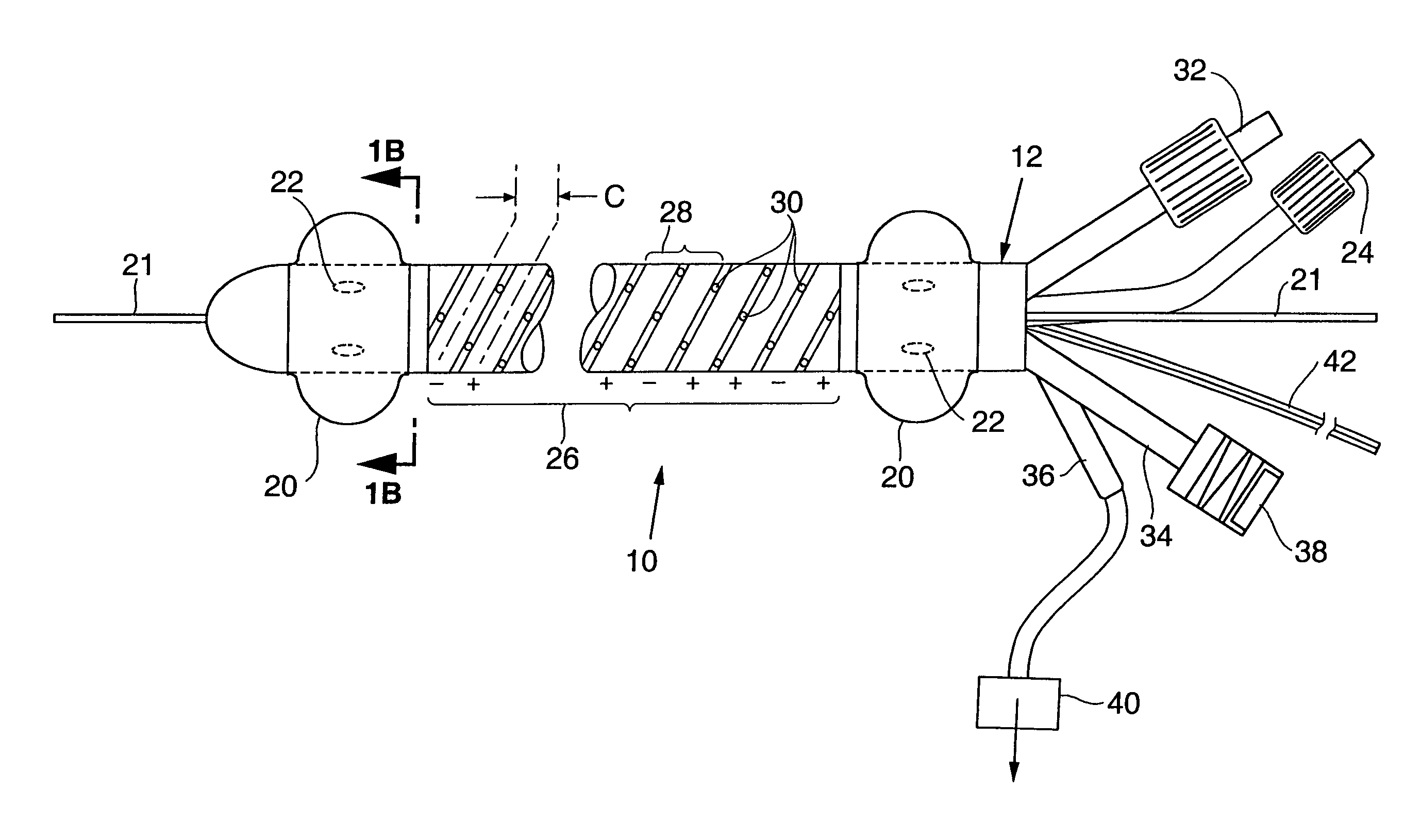 Apparatus and method for treating venous reflux