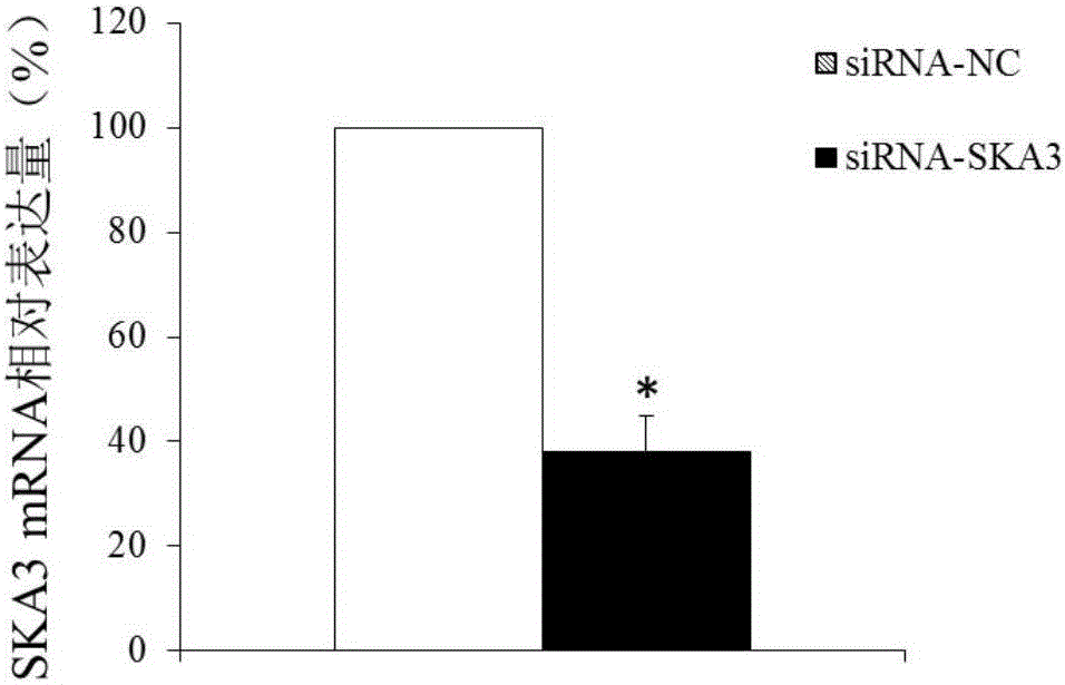 Molecular marker for diagnosing and treating endometrial cancer