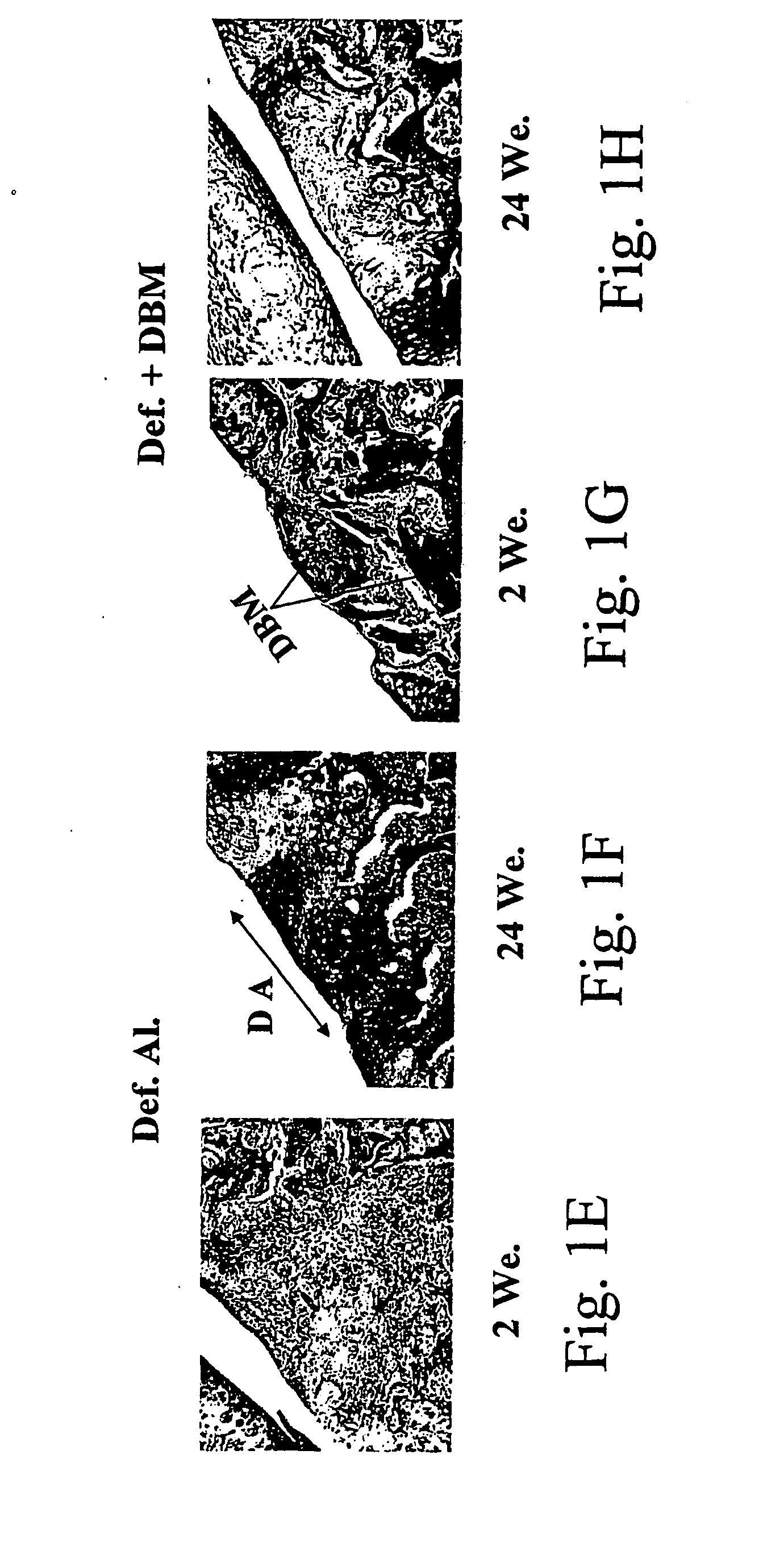 Compositions comprising bone marrow cells together with demineralized and/or mineralized bone matrix and uses thereof in the induction of bone and cartilage formation