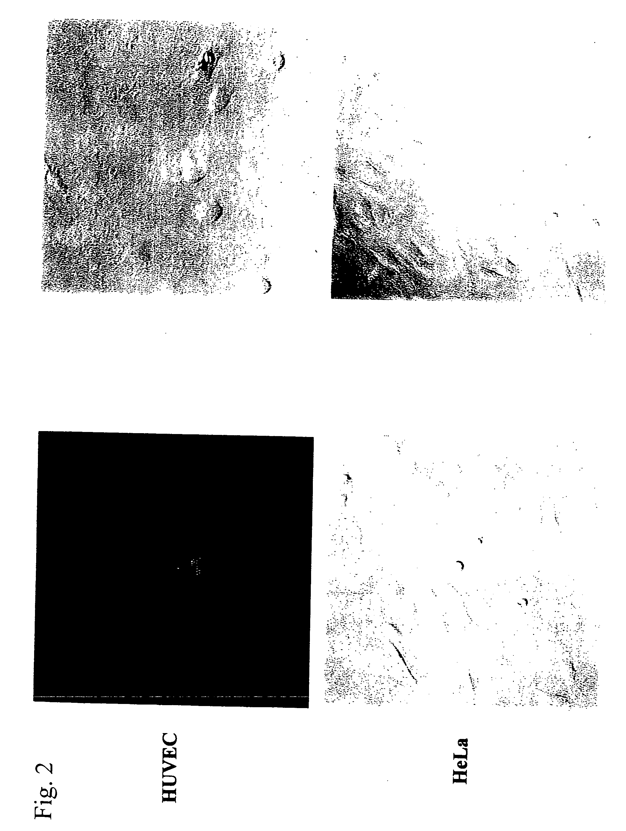 Cell death-inducing fused gene acting specifically on cancer and gene product thereof