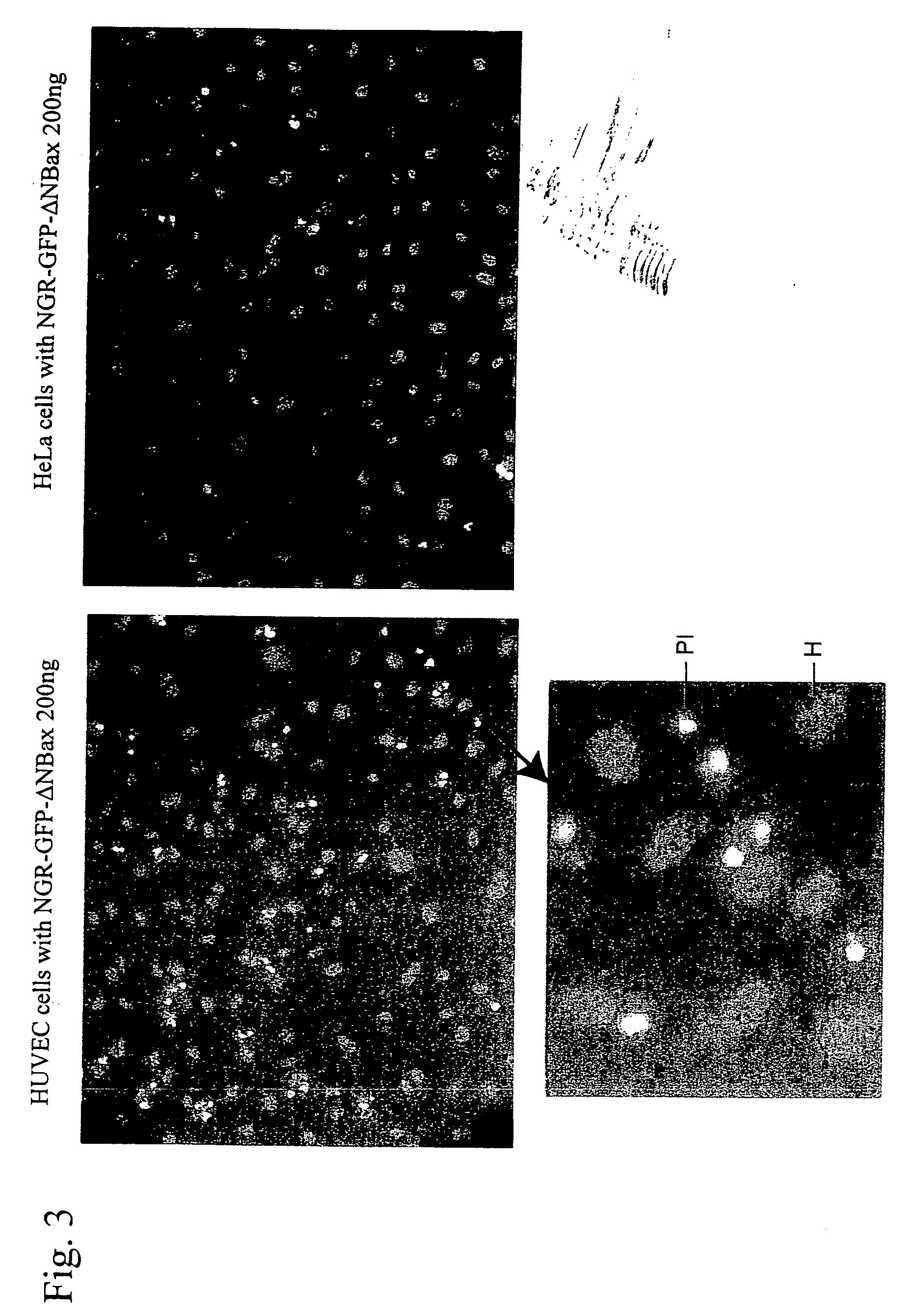 Cell death-inducing fused gene acting specifically on cancer and gene product thereof