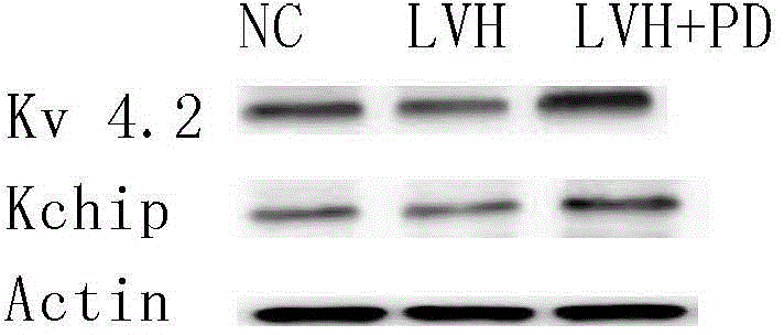 Purposes of polydatin in preparing anti-arrhythmic products