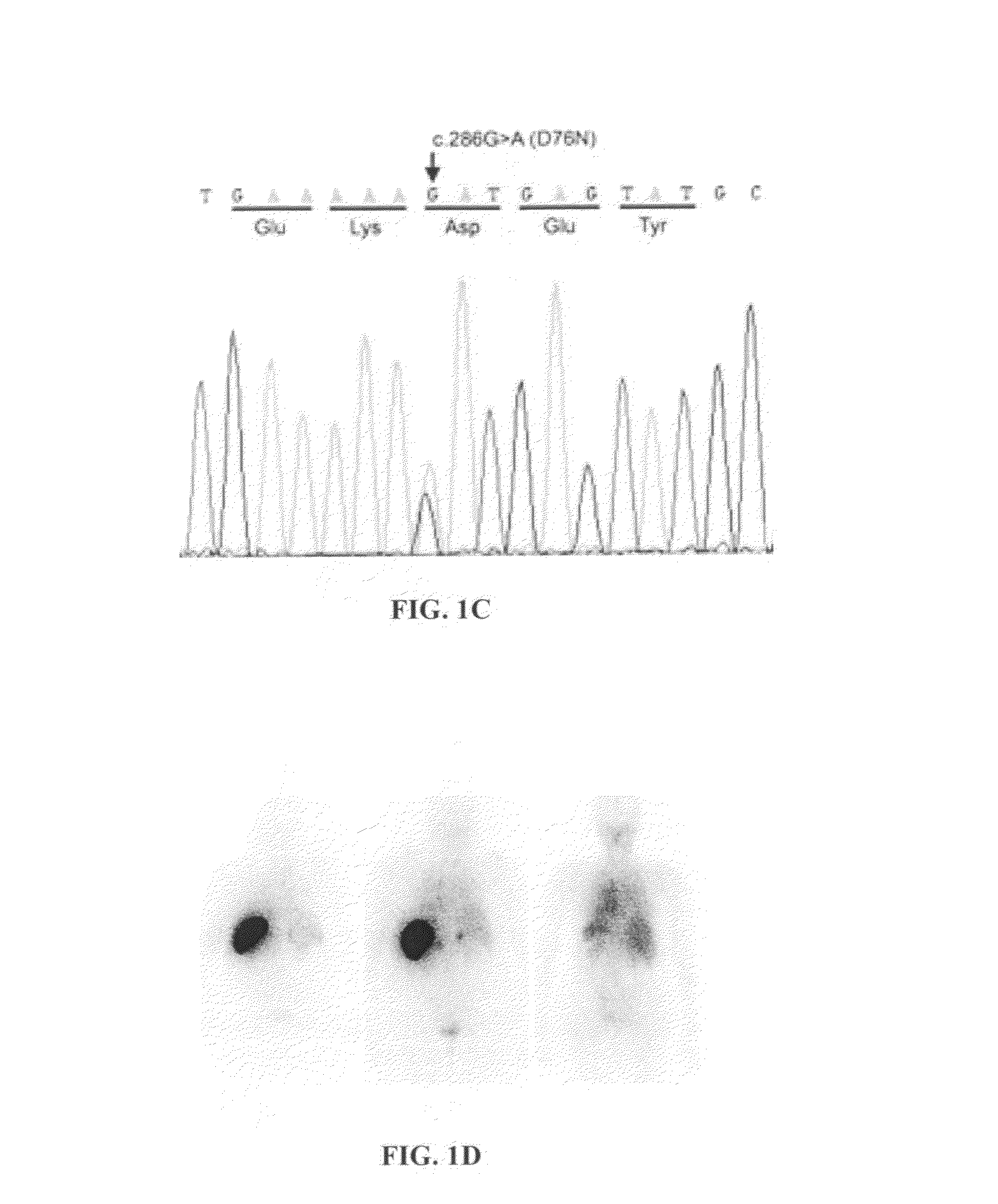 Variant Beta2-microglobulin, characterization of the same and applications thereof