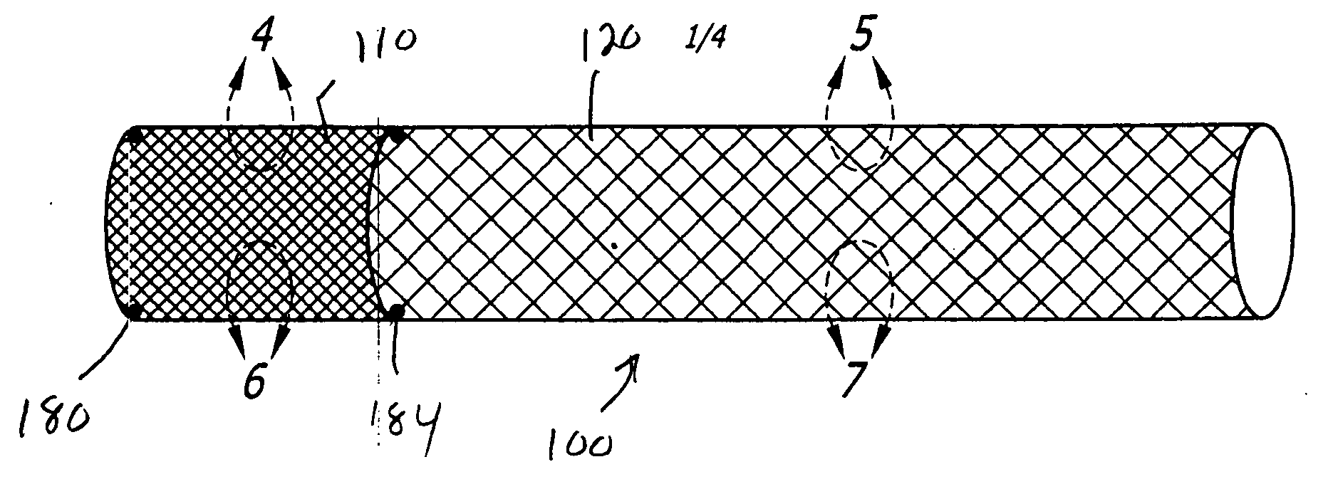 Drug eluting stent for the treatment of dialysis graft stenoses