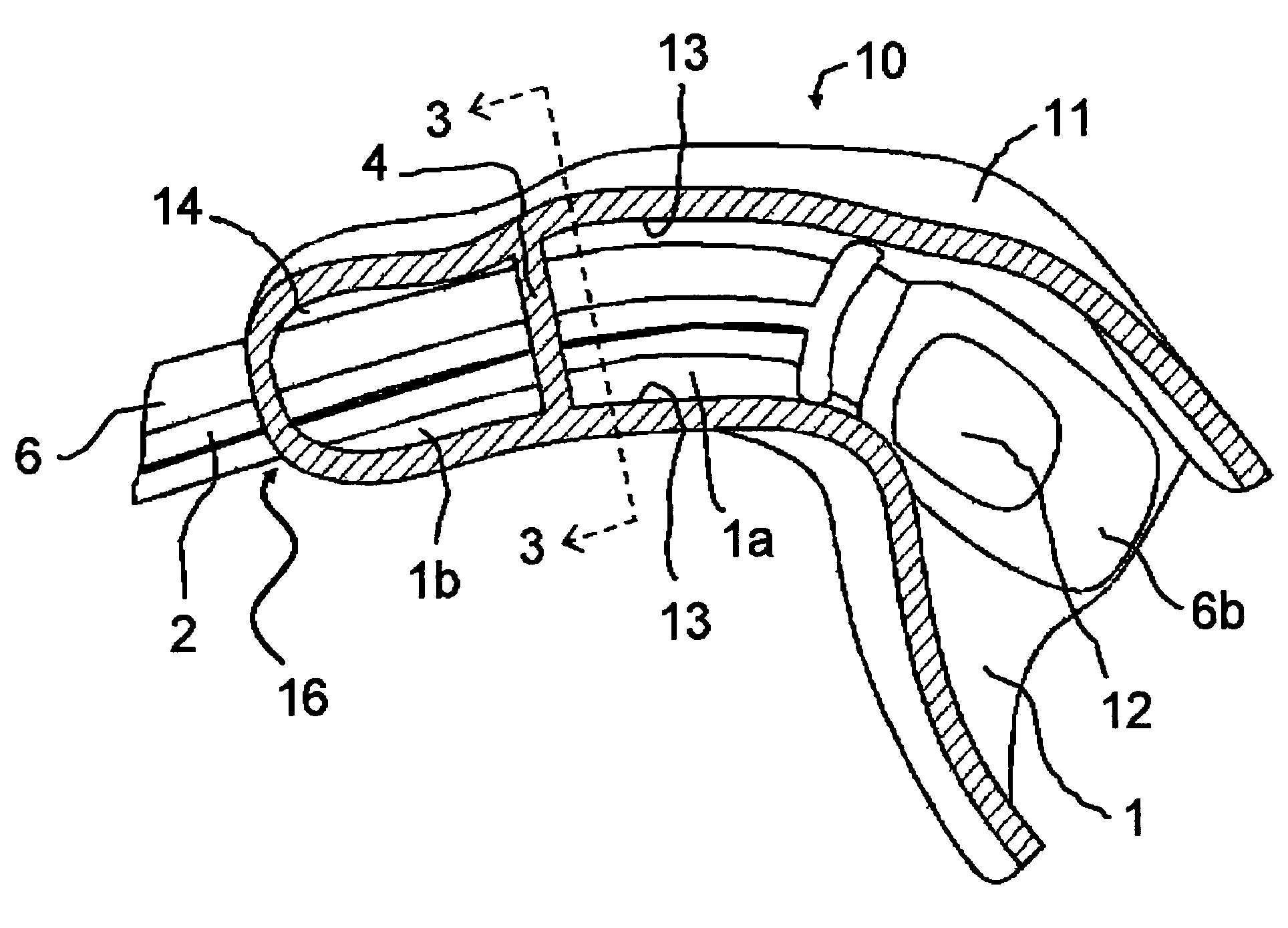 Hearing instrument receiver mounting arrangement for a hearing instrument housing