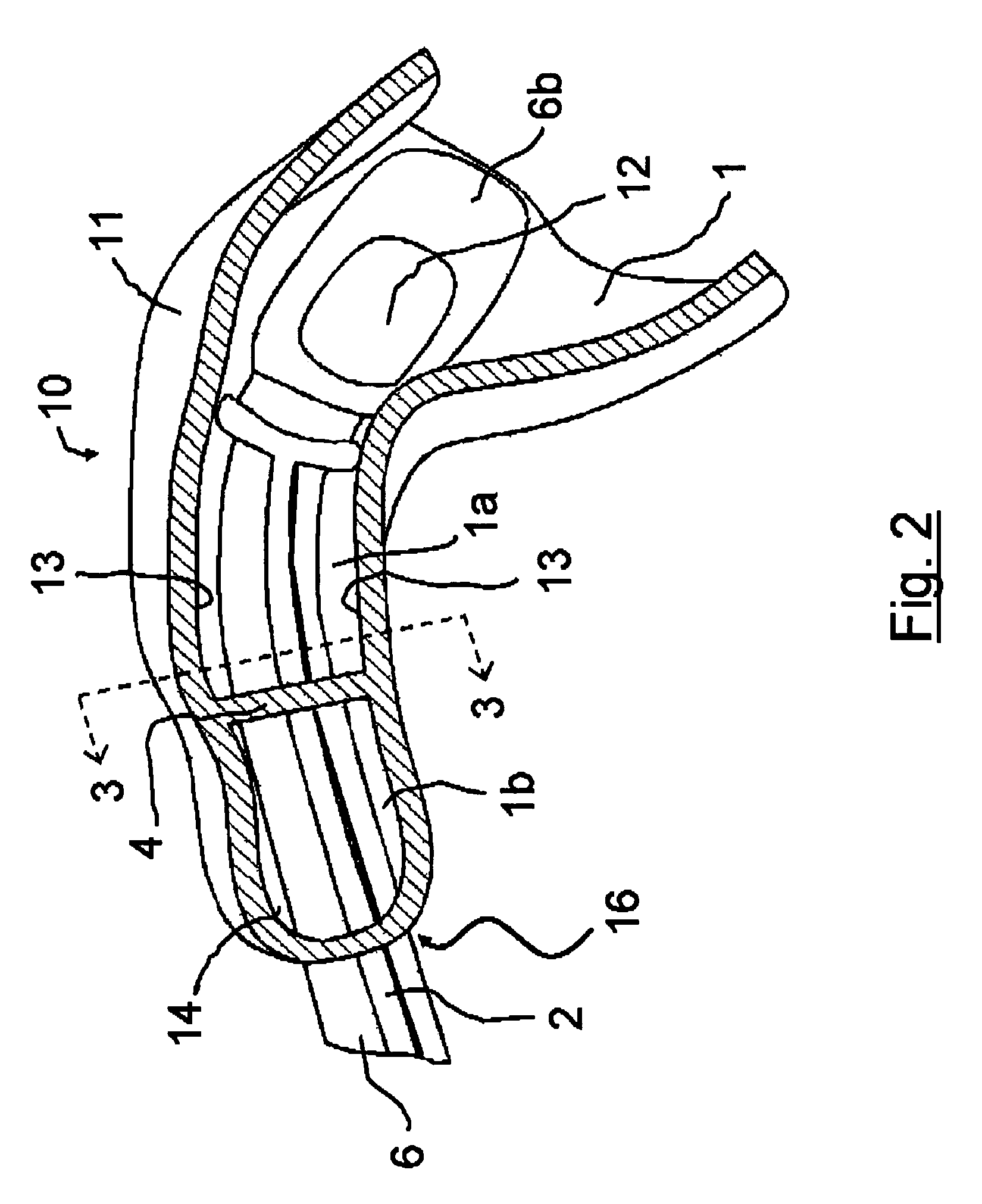 Hearing instrument receiver mounting arrangement for a hearing instrument housing