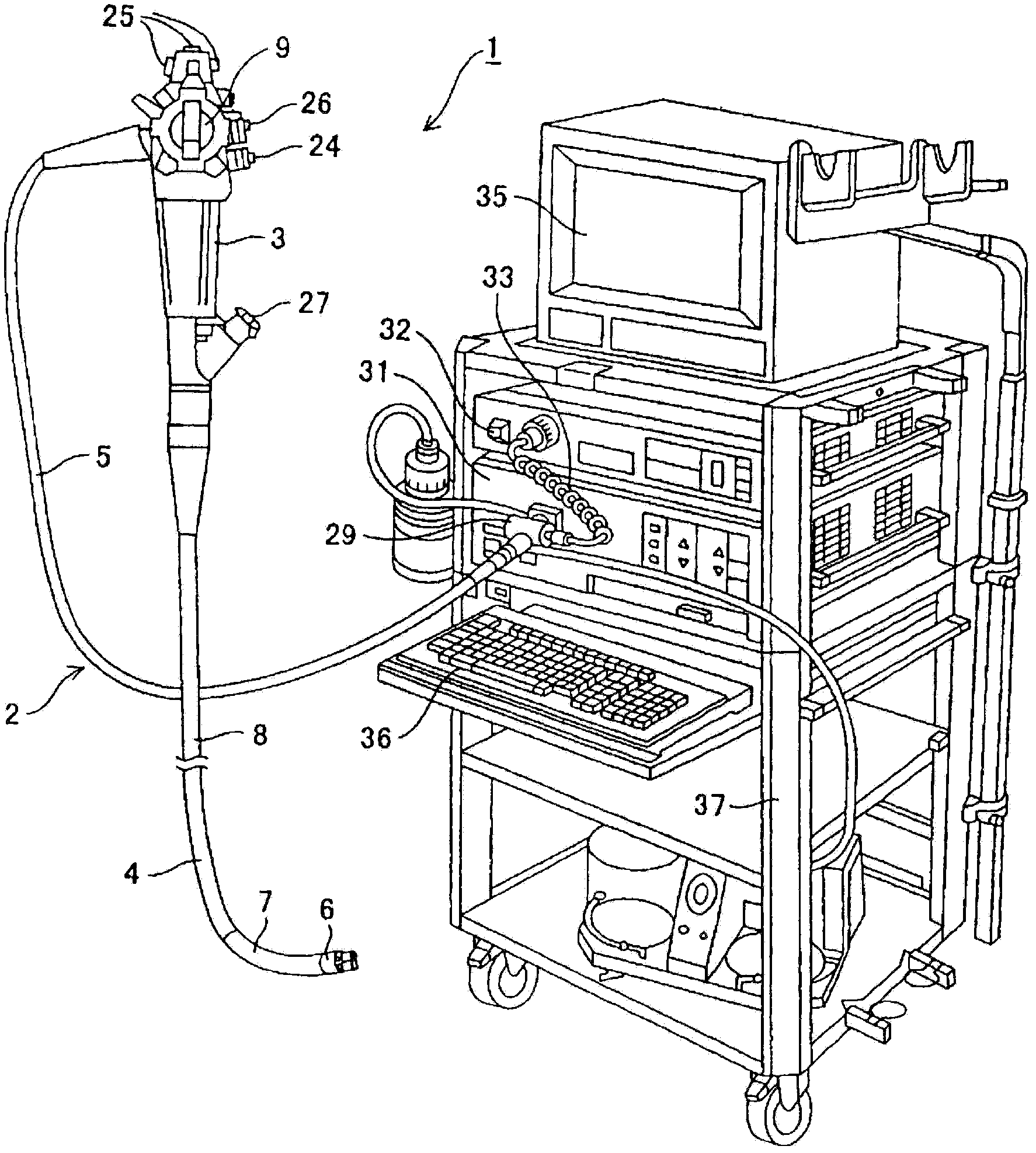 Endoscope