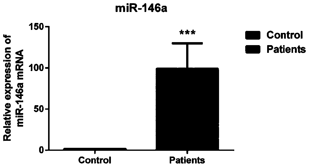 Application of miR-146a in preparation of products for diagnosing steroid-induced femoral head necrosis