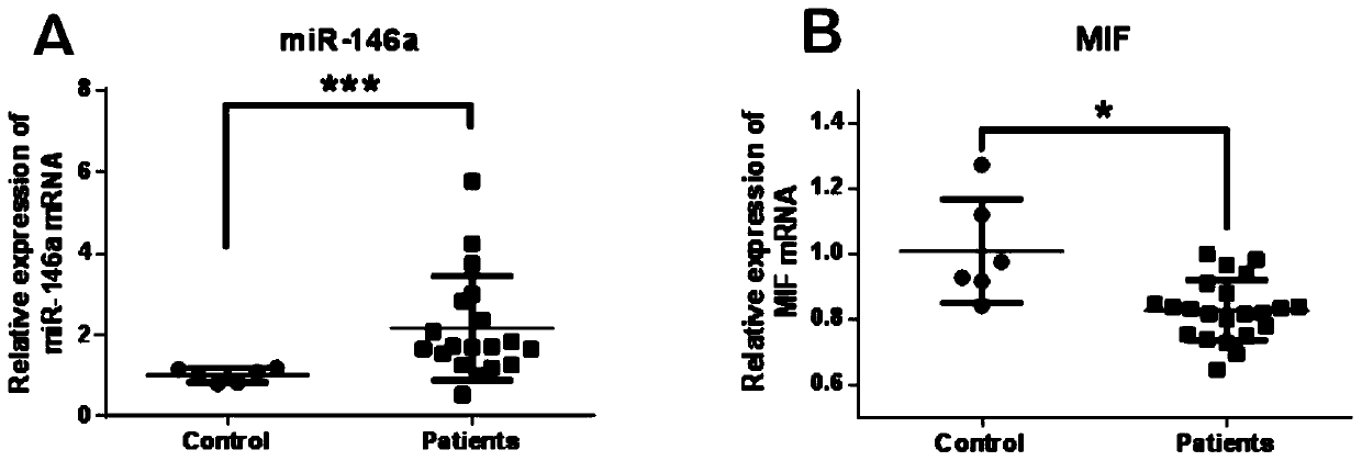 Application of miR-146a in preparation of products for diagnosing steroid-induced femoral head necrosis