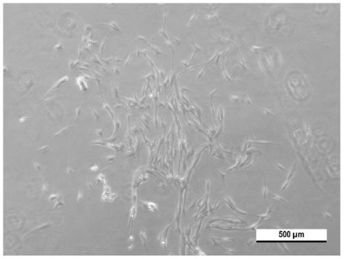 Method for separating, culturing and purifying endometrial cells