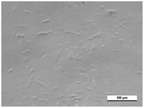 Method for separating, culturing and purifying endometrial cells