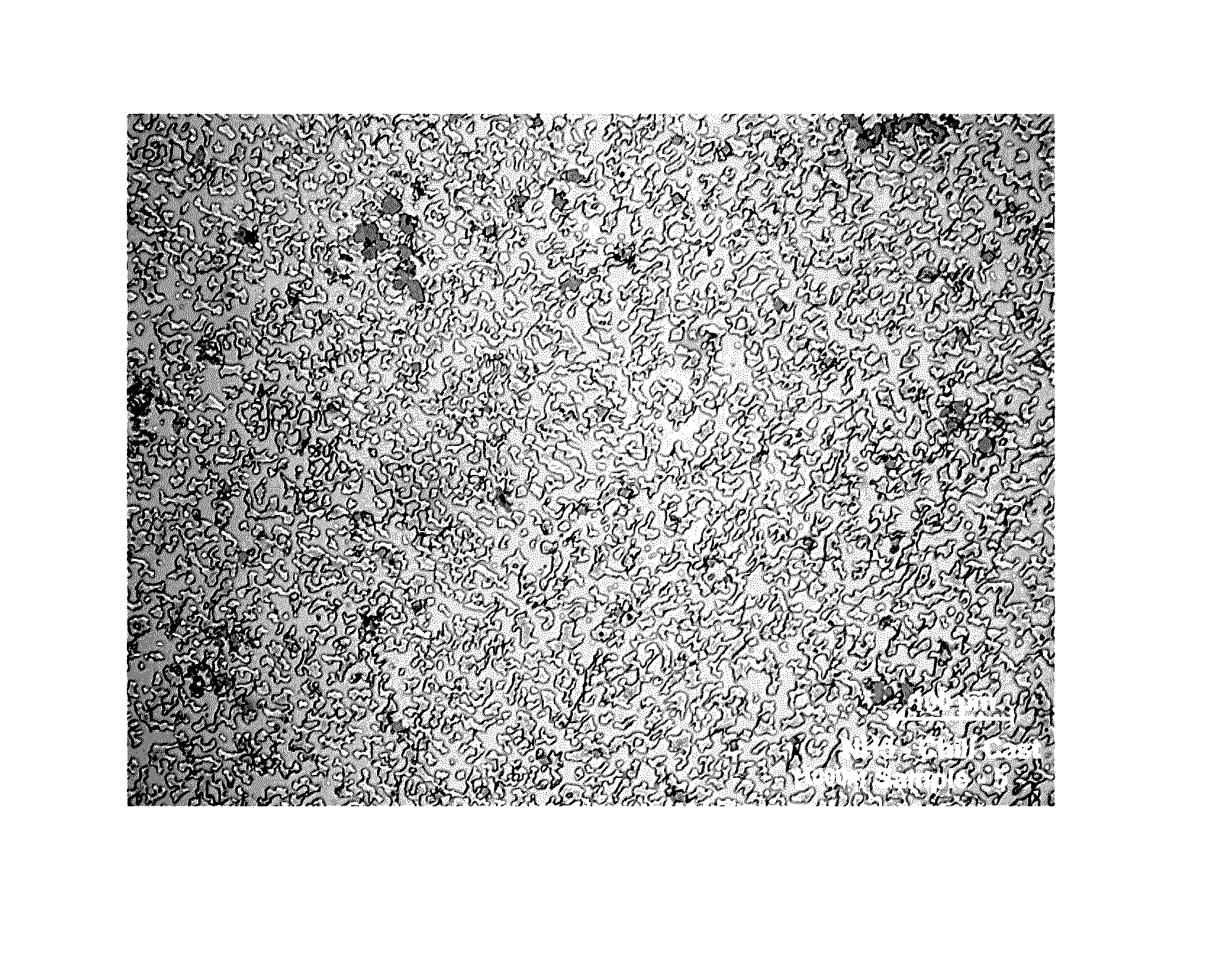 Hypereutectic white iron alloys comprising chromium, boron and nitrogen and articles made therefrom