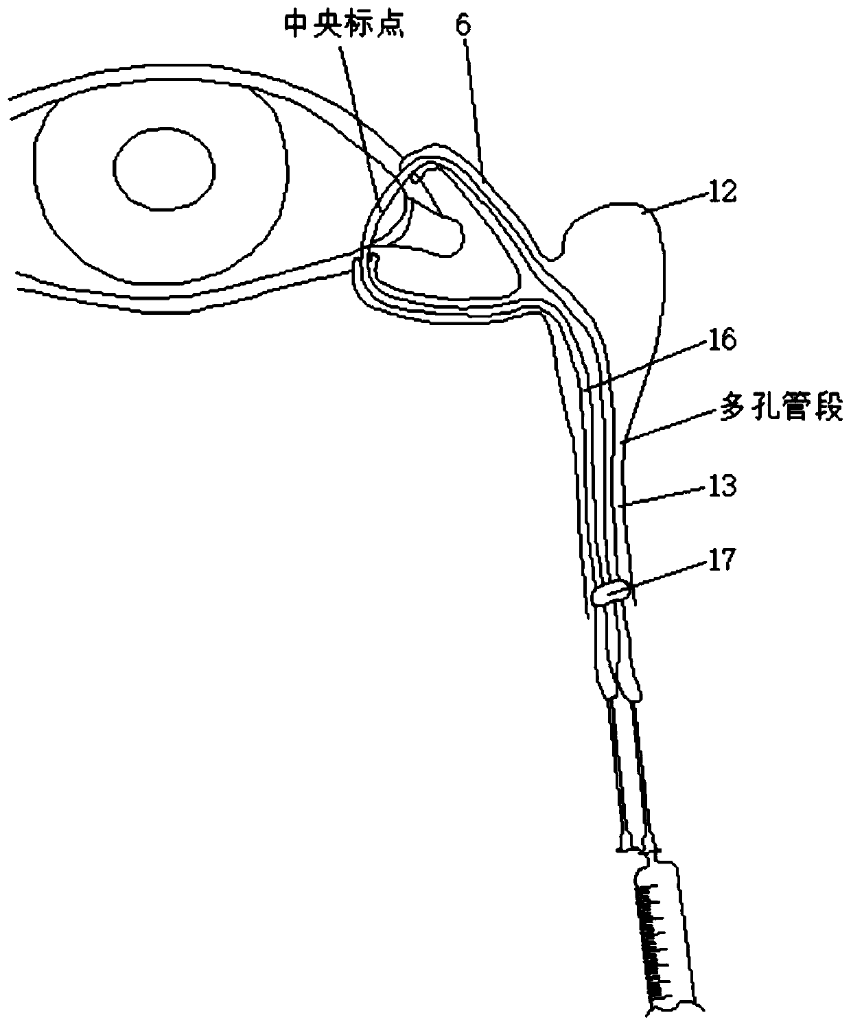 Surgical operation method