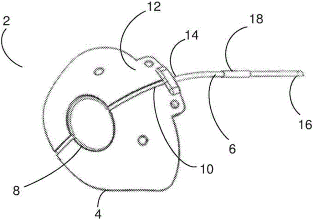 An ocular drainage device and method of manufacturing thereof