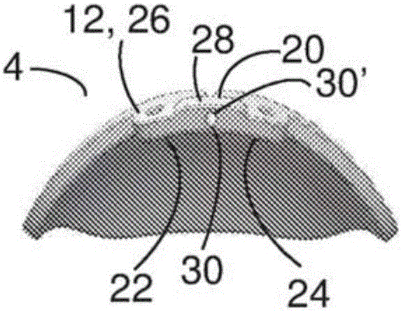 An ocular drainage device and method of manufacturing thereof