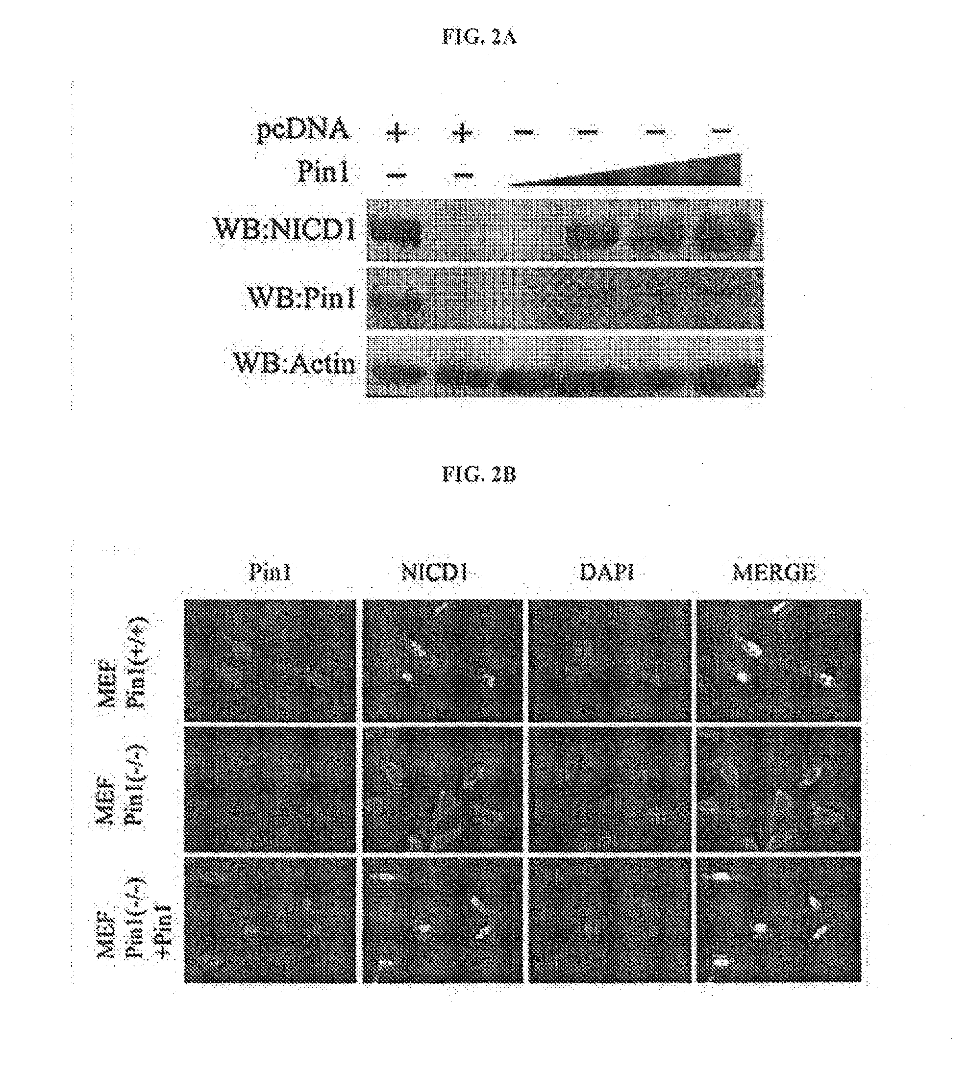 Composition for the prevention or treatment of the symptoms in the stroke comprising the inhibitor of Pin1