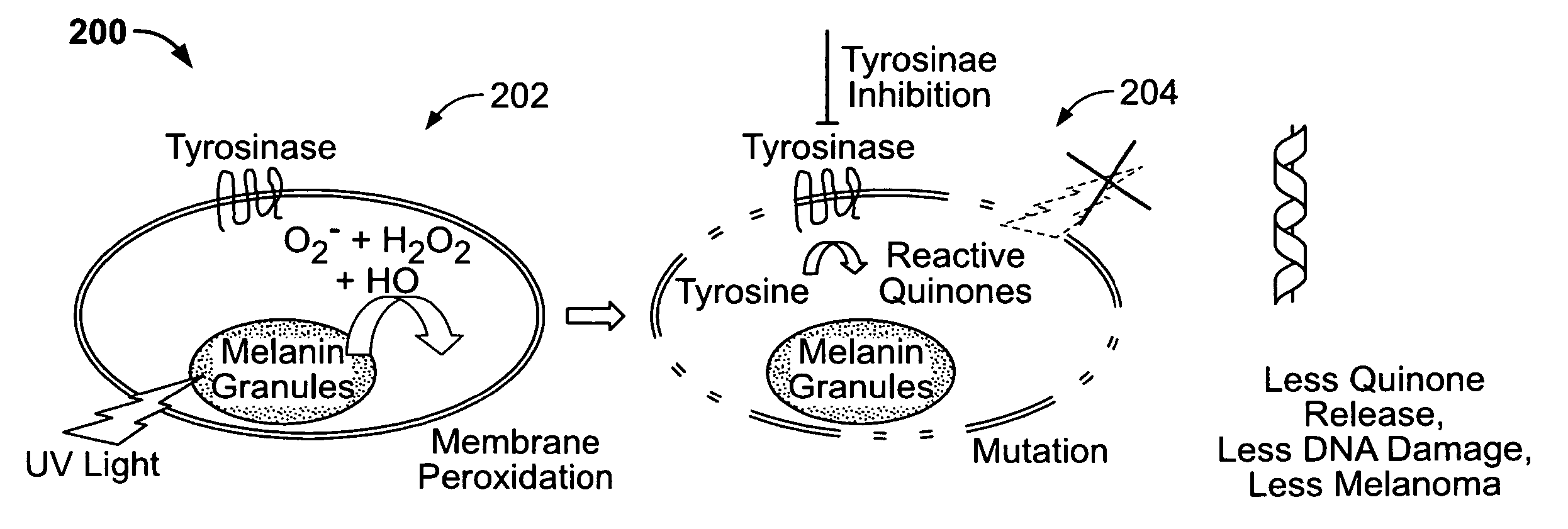 System and methods of melanoma prevention