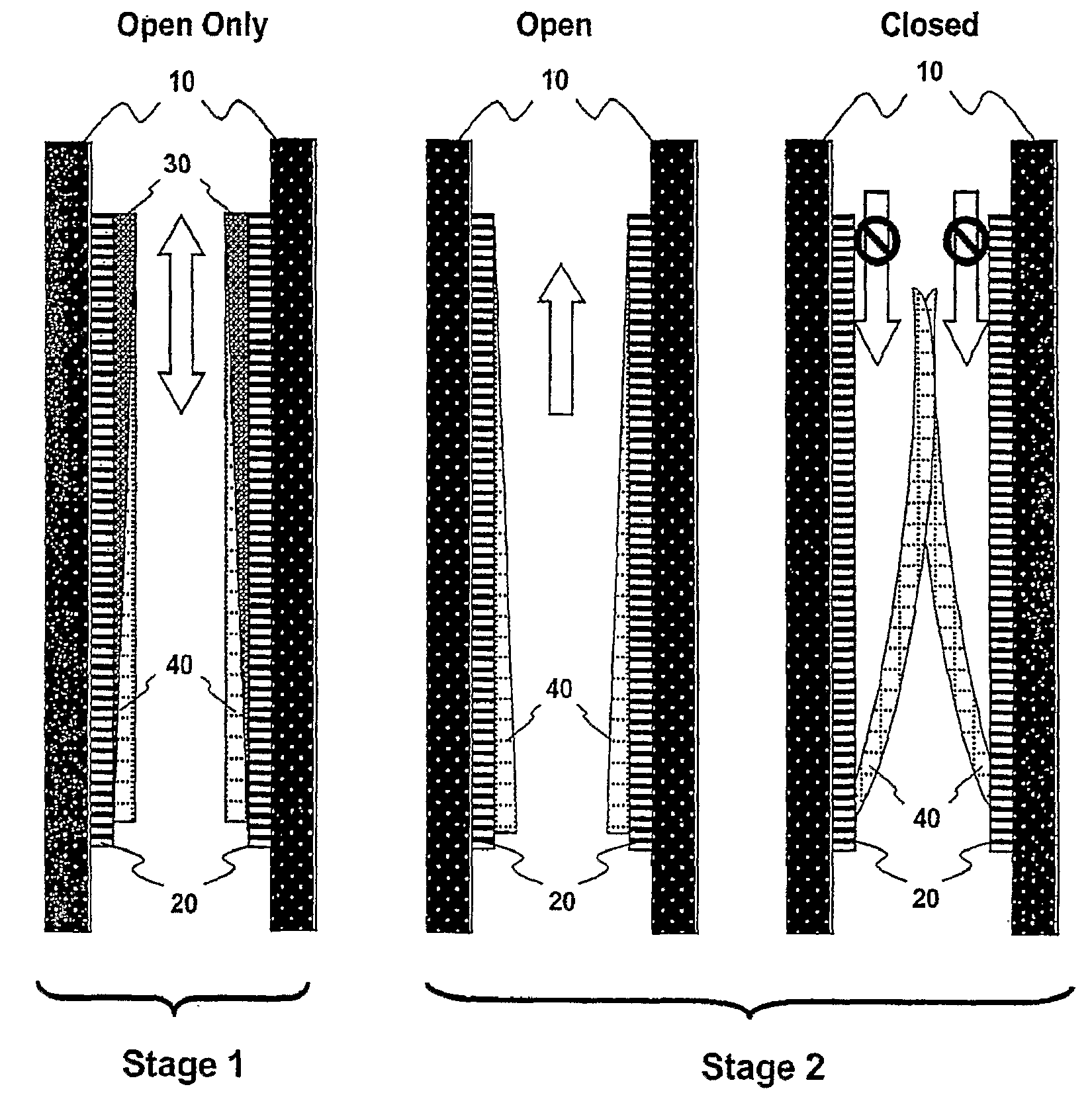 Implantable Prosthetic Valve