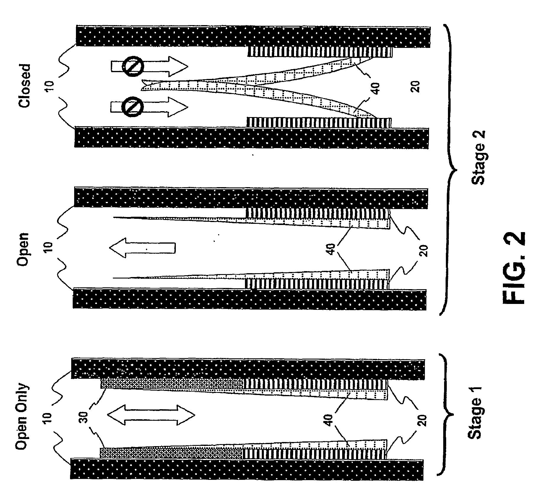 Implantable Prosthetic Valve