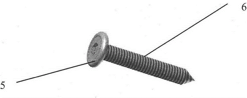 Hook plate complex for locking acromioclavicular joint