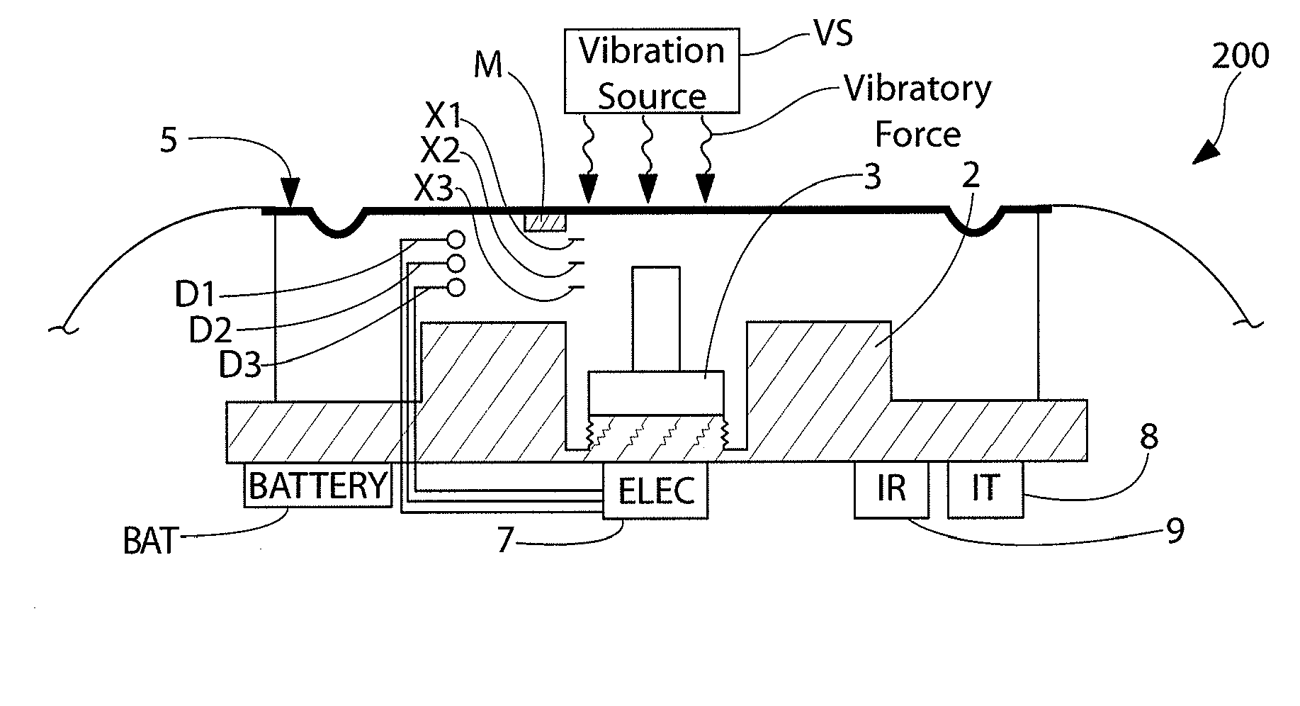 Implantable pressure sensor