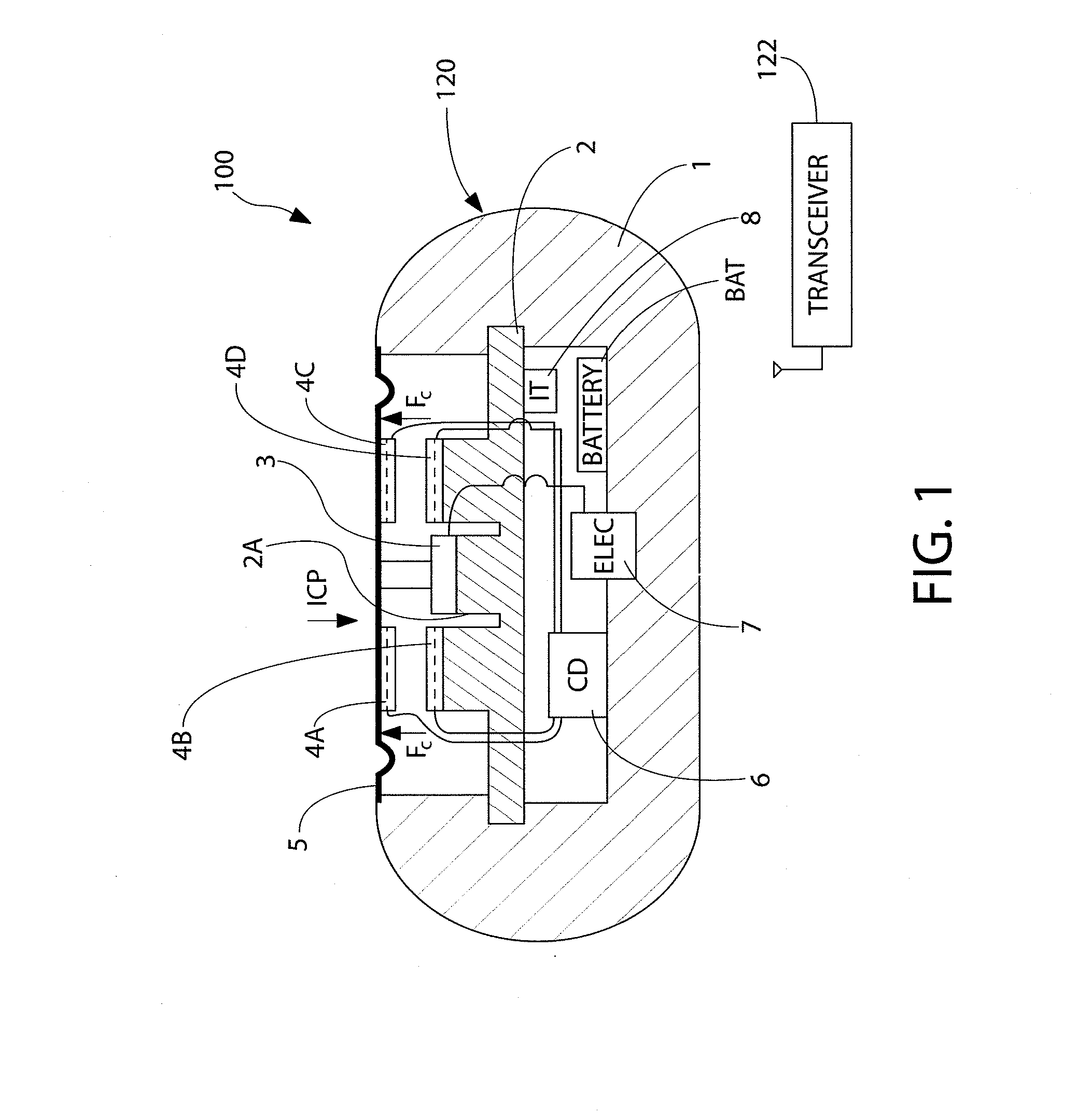 Implantable pressure sensor